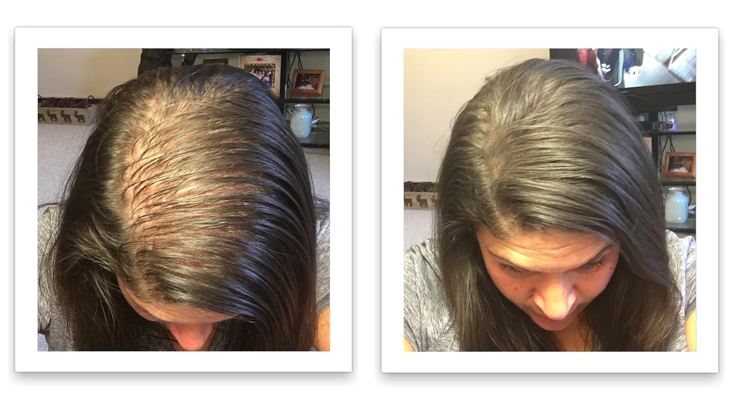 Hair Loss Concealer. Cover Bald Spot and Thinning Hair Instantly. Make Thin Hair Look 10X Fuller. All-Natural Hair Building Fiber. Trial Size (10-Day Supply). Dark Brown - Image 7