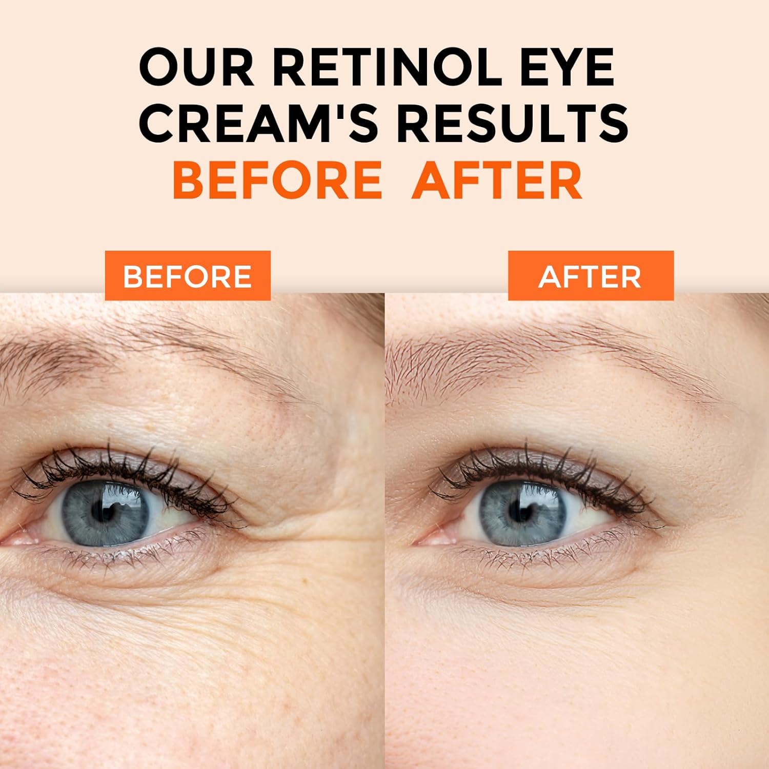 Retinol Eye Cream for Dark Circles and Puffiness, Anti Aging Under Eye Cream with Hyaluronic Acid, Retinol & Collagen to Fight Fine Lines, Wrinkles & Dark Spots - Image 4
