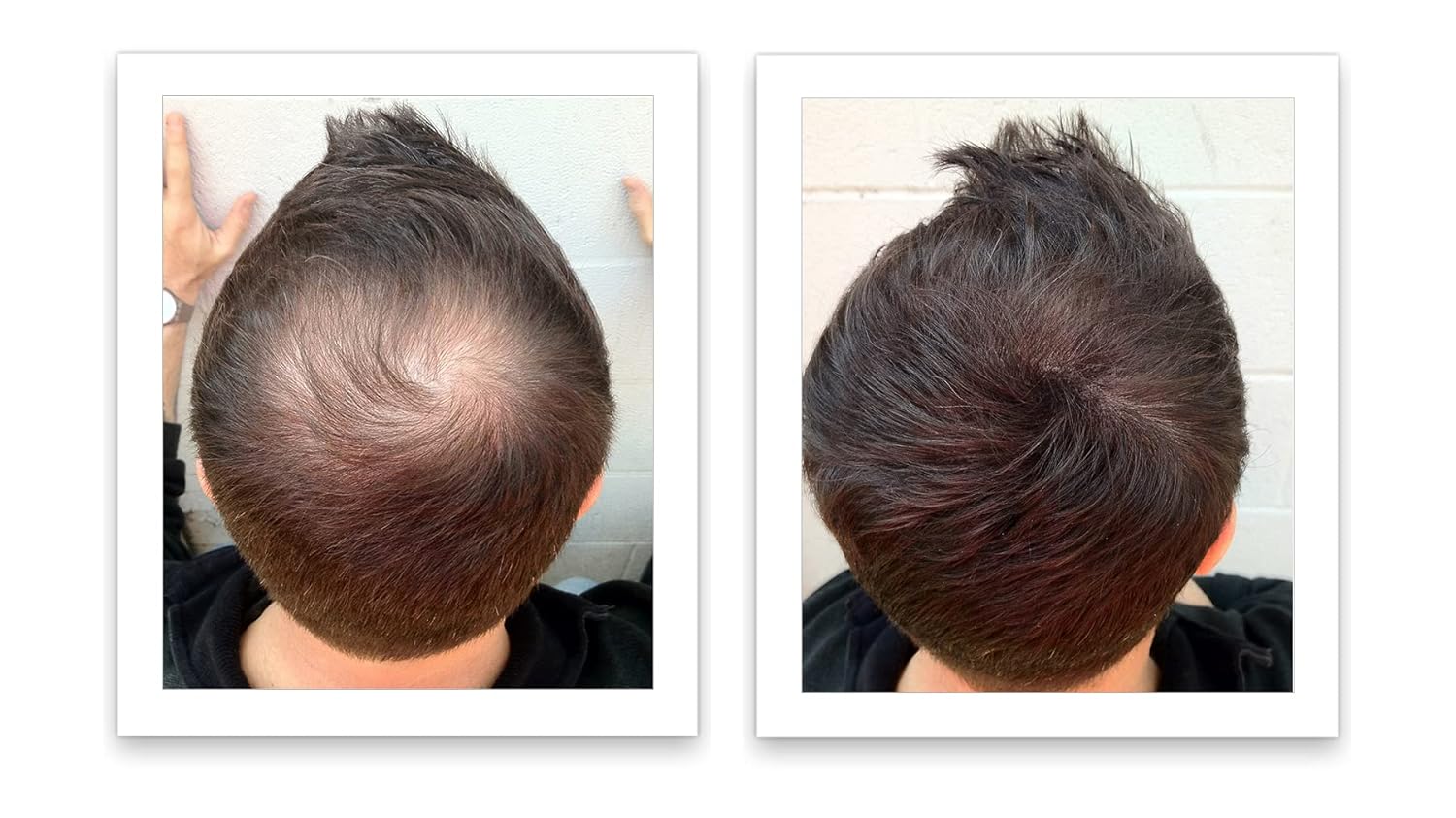 Hair Loss Concealer. Cover Bald Spot and Thinning Hair Instantly. Make Thin Hair Look 10X Fuller. All-Natural Hair Building Fiber. Trial Size (10-Day Supply). Dark Brown - Image 8