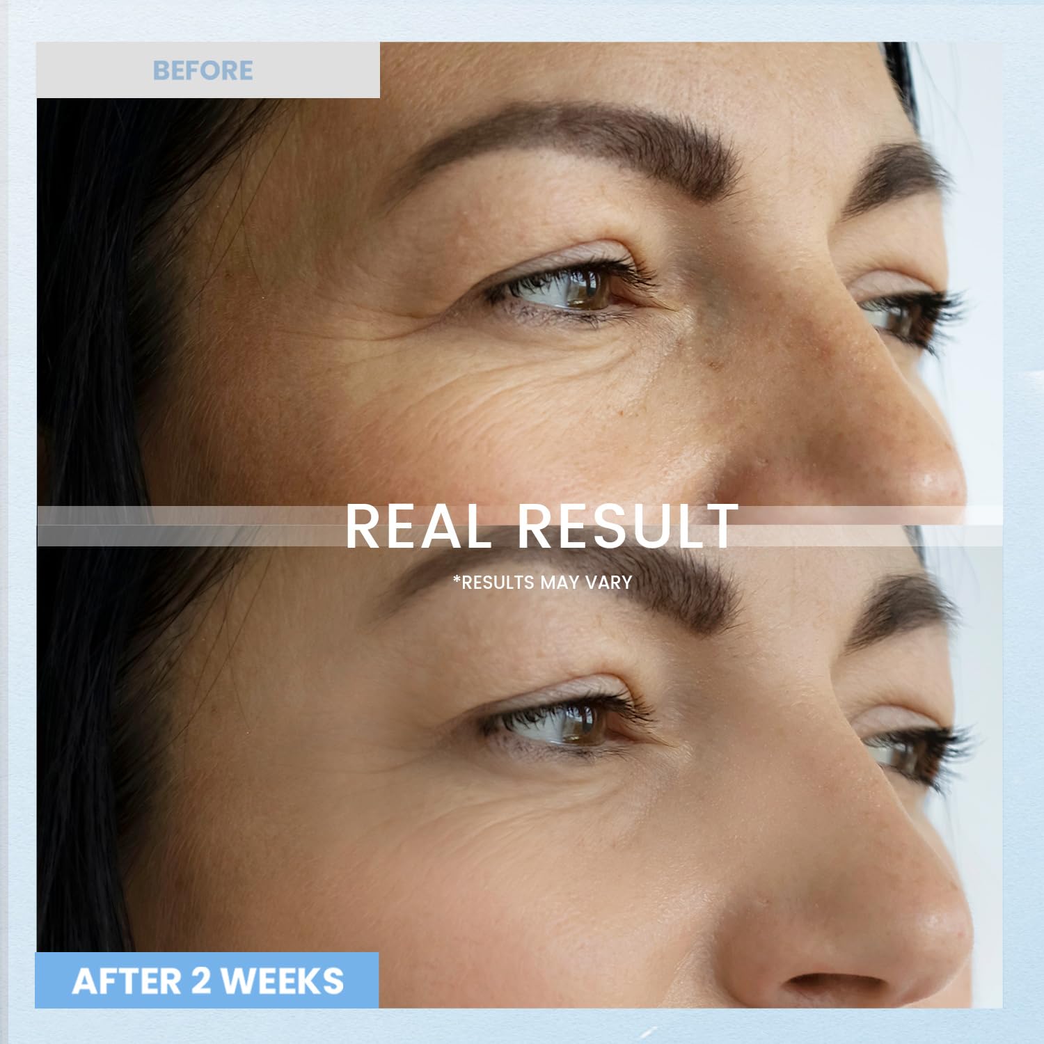 Retinol Eye Cream for Dark Circles: Anti-Wrinkle Under Eye Cream - Night Care Eye Cream Reduces Eye Bags - Image 4