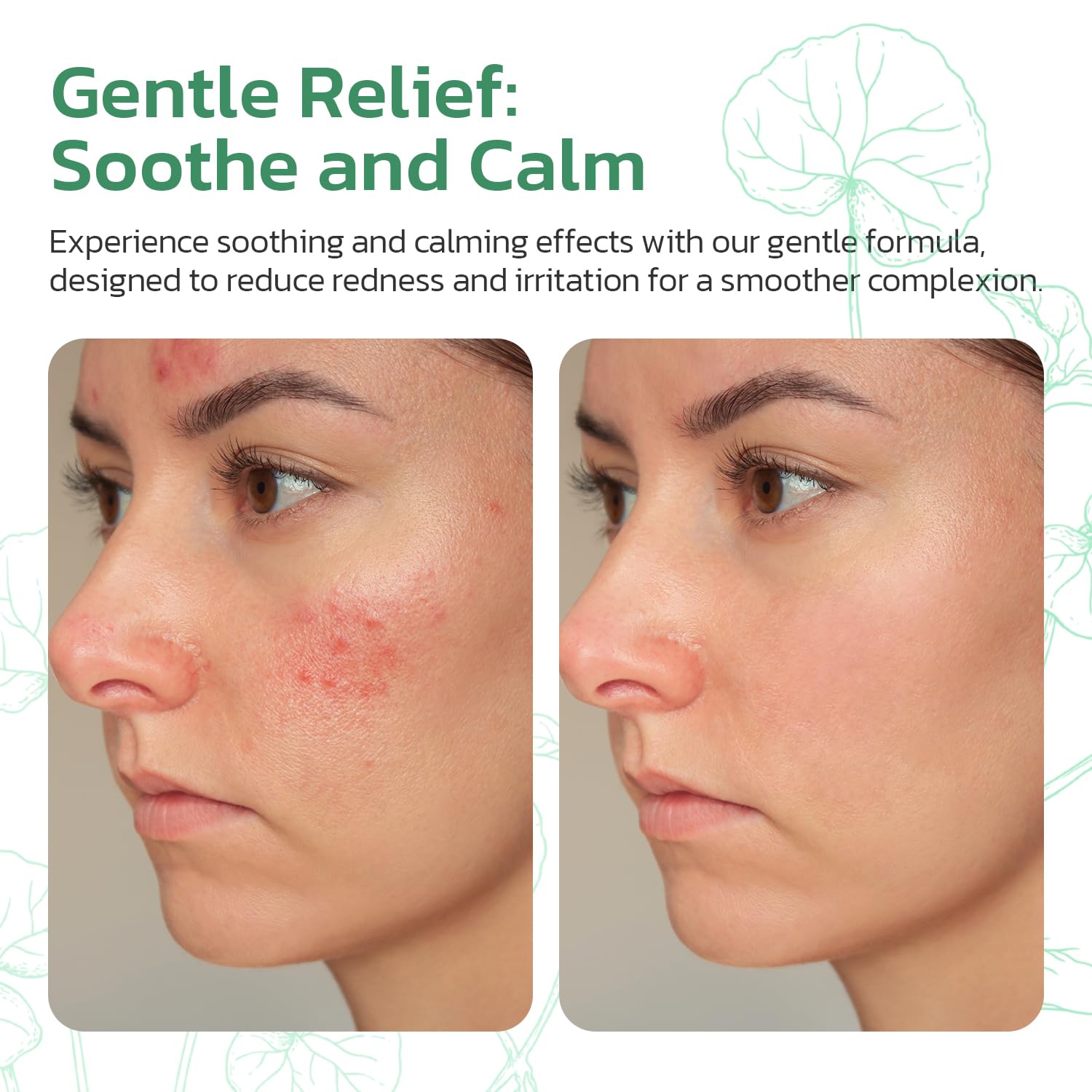Centella Asiatica Moisturizer Phytocin Cream Centella Soothing Moisturizer for Dry, Sensitive, Acne Prone Skin with PDRN,Ceramide 30ML 1.01fl.oz - Image 5