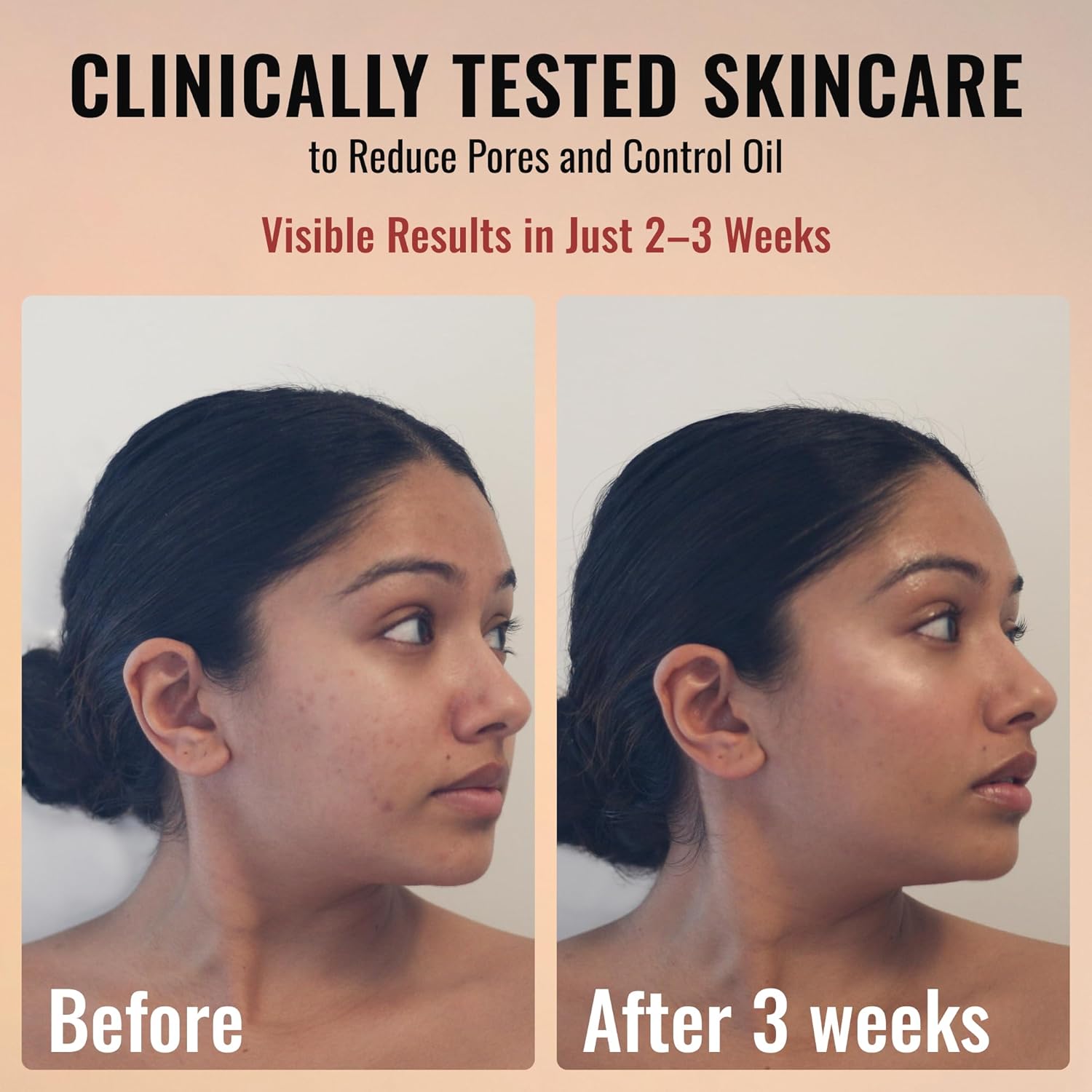 ADM Anti Aging Pure Retinol Serum For Face with Niacinamide - Resurfacing, Smoothing Fine Lines, Wrinkles, Acne Scars - Moisturizing Facial Skincare Treatment for Sensitive Skin - 1oz - Image 3