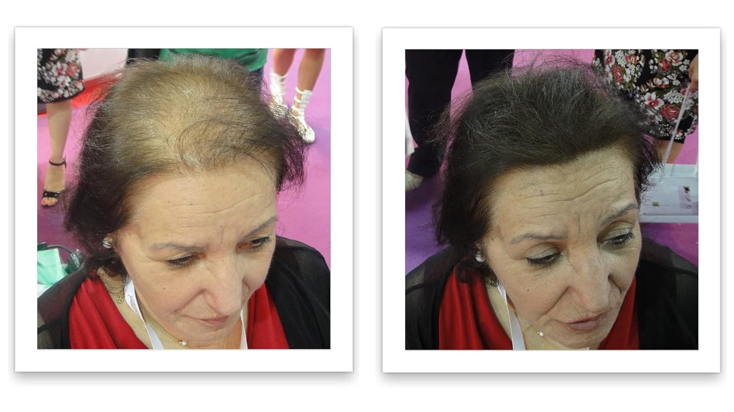 Hair Loss Concealer. Cover Bald Spot and Thinning Hair Instantly. Make Thin Hair Look 10X Fuller. All-Natural Hair Building Fiber. Trial Size (10-Day Supply). Dark Brown - Image 4