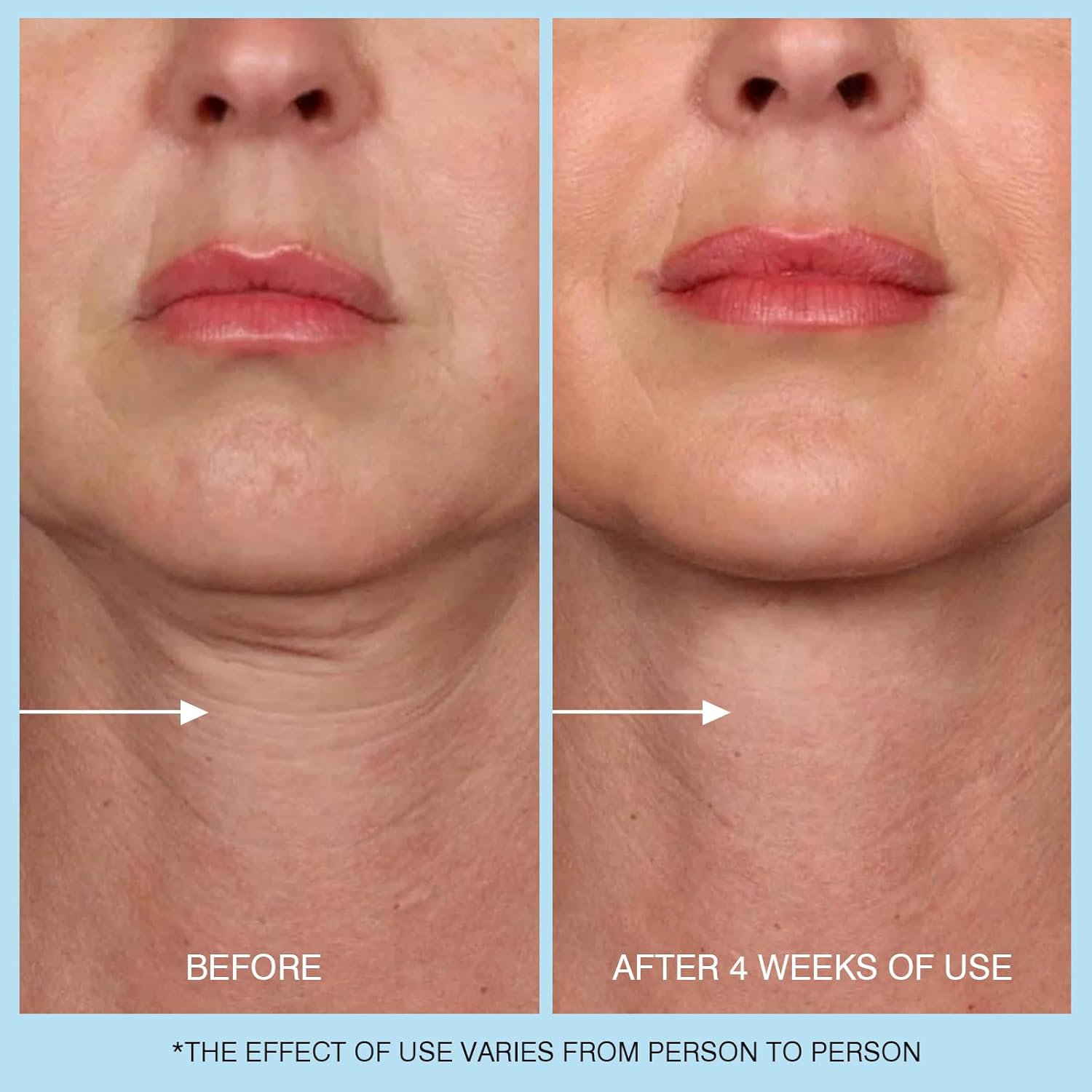 Retinol Neck Cream, Hyaluronic Acid and Caffeine Enriched Neck Firming Cream to Minimize Fine Lines & Dullness - 3-in-1 Moisturizing Cream for Neck, Chest and Face (50 ml/1.7 oz) - Image 6