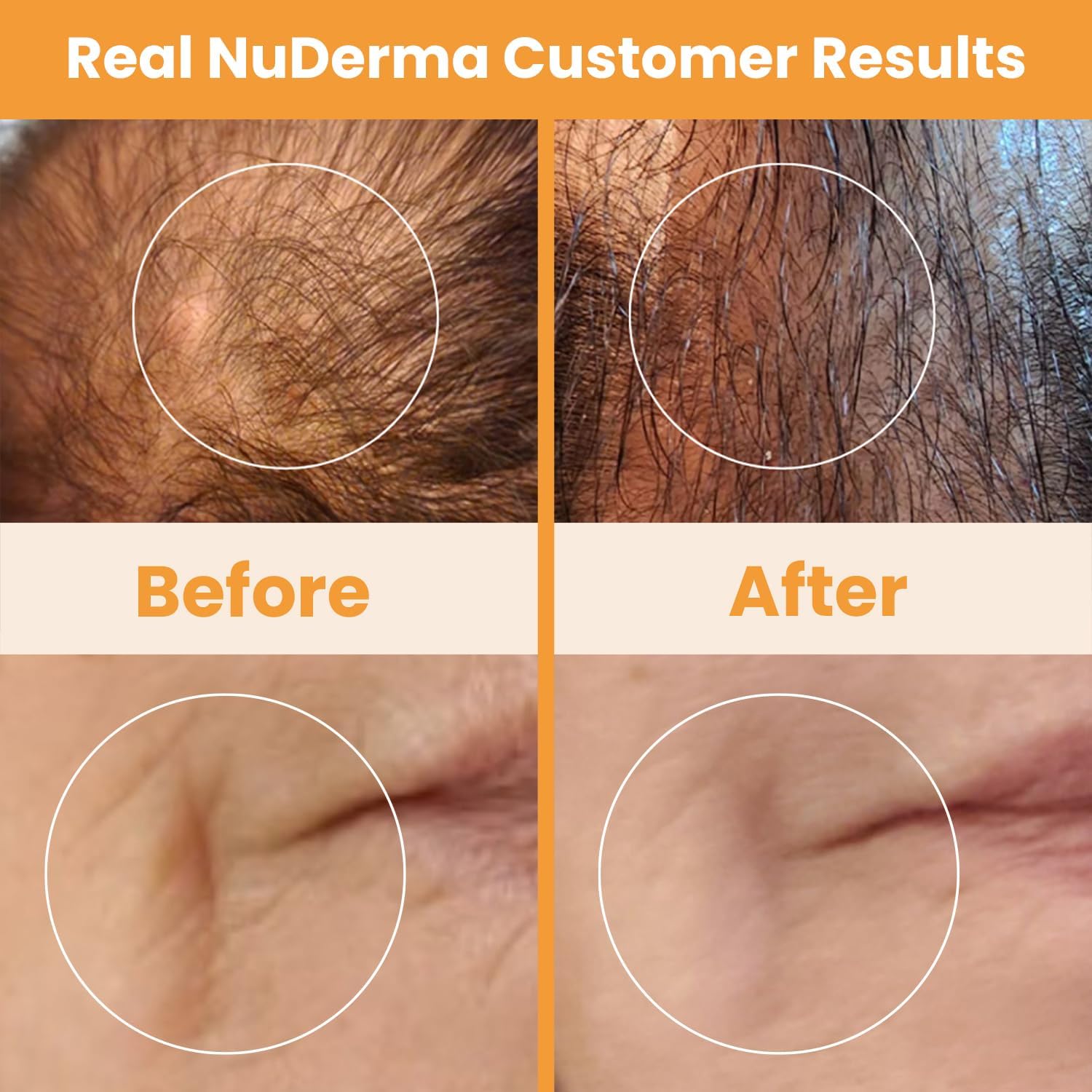 NuDerma Handheld Skin Therapy Wand Machine w/Neon – Anti-Aging - Skin Tightening - Wrinkle Reducing - Dark Circles – Clarifying - Hair & Scalp Stimulator - Image 7