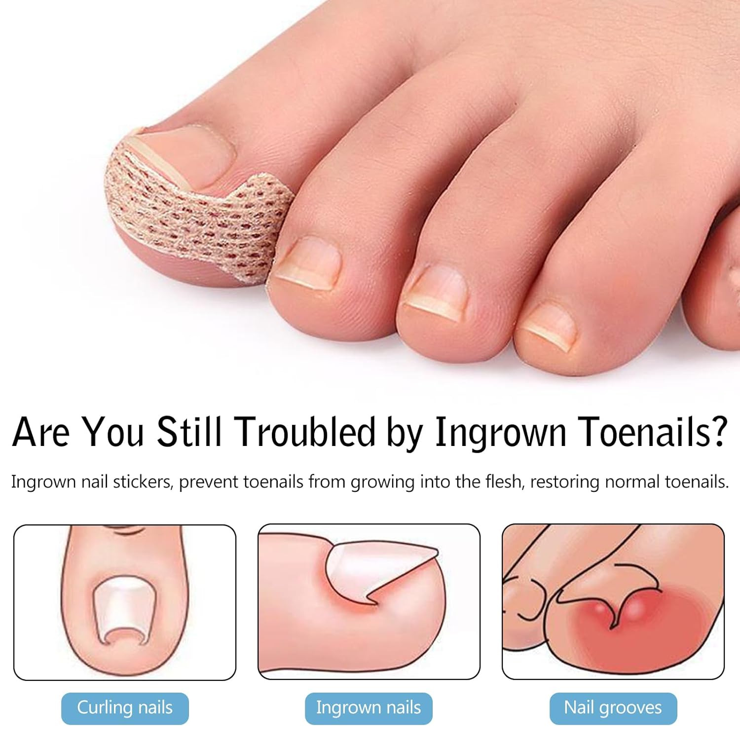 Ingrown Toenail Treatment, 100 Pcs Breathable Ingrown Toenail Strips,Painless Ingrown Toenail Tool, Professional Pedicure for Toenail Corrector Patch - Image 3