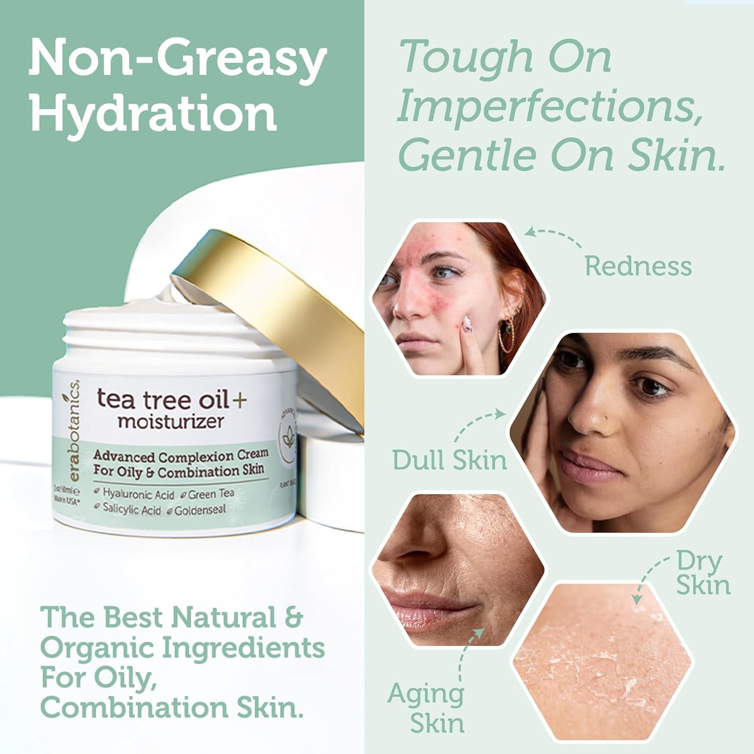 Era Organics Tea Tree Cream Face Moisturizer for Oily Skin - Advanced 7X Balancing Oily Skin Moisturizer - Non-Greasy Moisturizer - Tea Tree Oil for Skin - Image 5