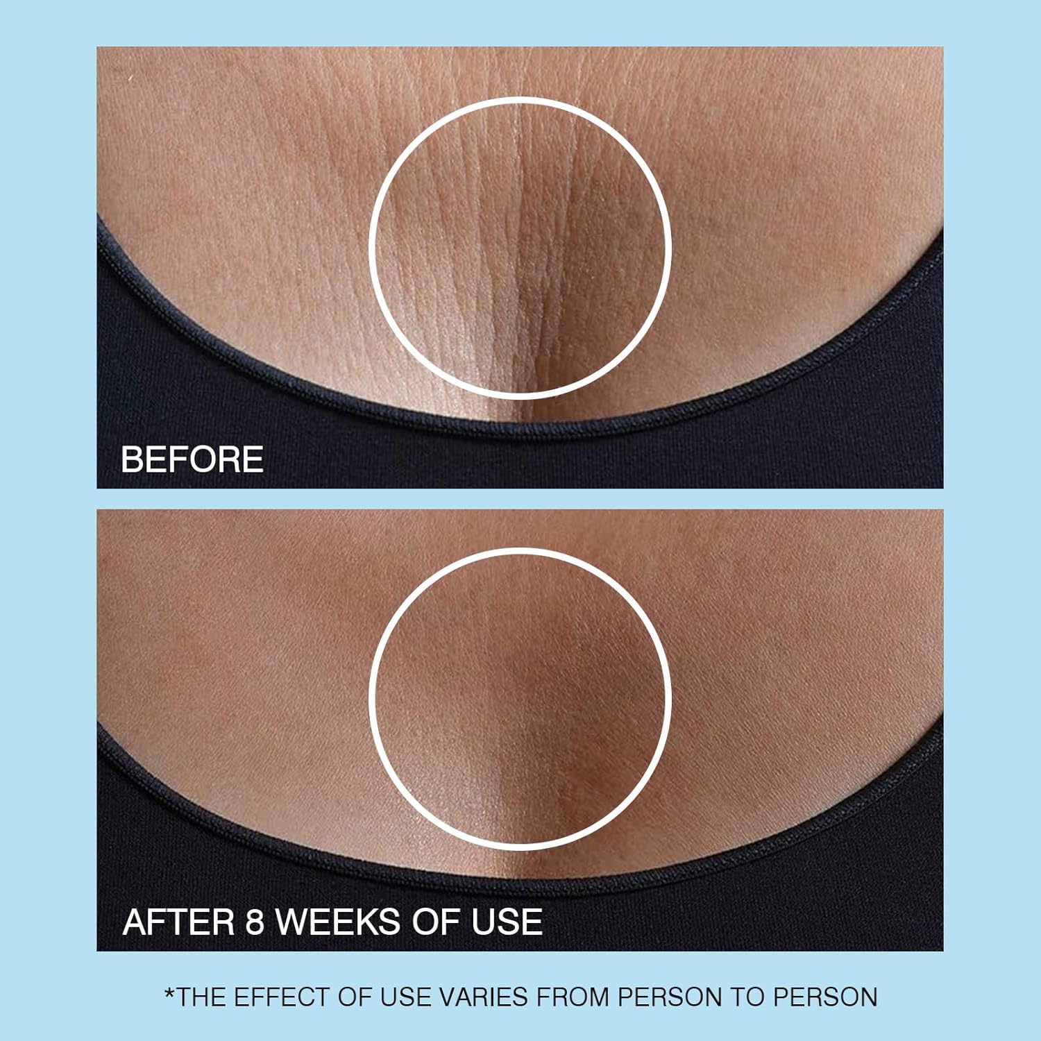 Retinol Neck Cream, Hyaluronic Acid and Caffeine Enriched Neck Firming Cream to Minimize Fine Lines & Dullness - 3-in-1 Moisturizing Cream for Neck, Chest and Face (50 ml/1.7 oz) - Image 7