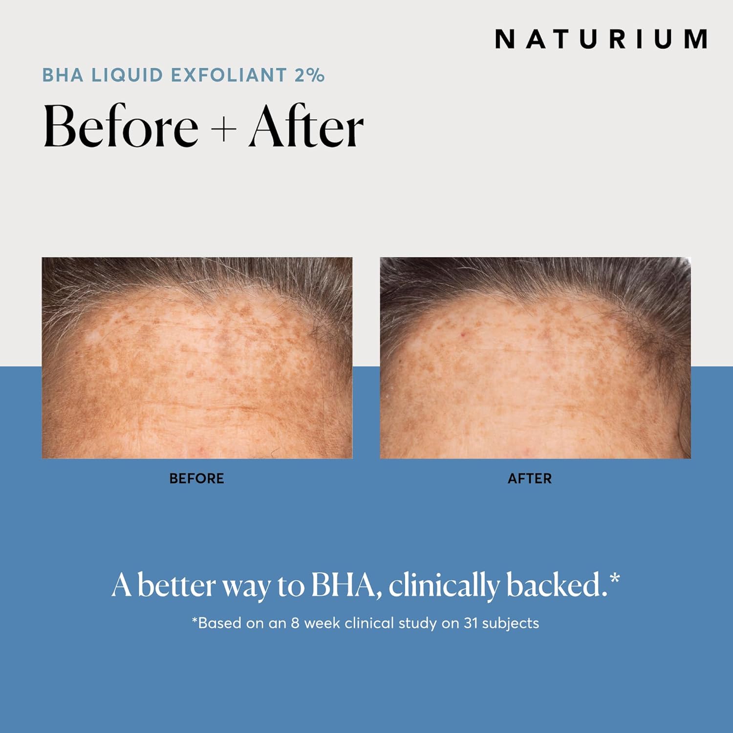 Naturium BHA Liquid Exfoliant 2%, Leave-on Face & Skin Care Exfoliating Pore Treatment, with Salicylic Acid & Bioactive Fruit Acids, Packaging May Vary, 4 oz - Image 4