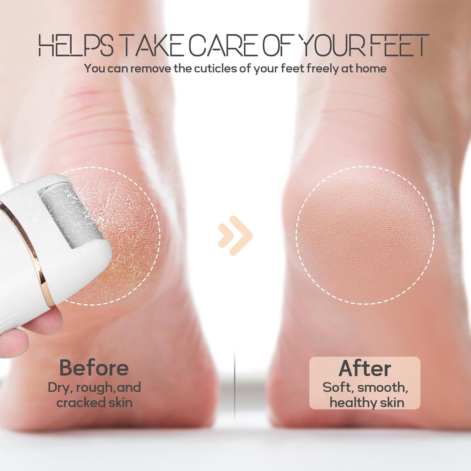 Automatic Callus Remover for Feet, Rechargeable Pedicure Tools for Feet, Electric Foot Callus Remover with 3 Roller Heads 2 Speed, Waterproof Foot File Perfect for Dead Hard Cracked Dry Skin - Image 5