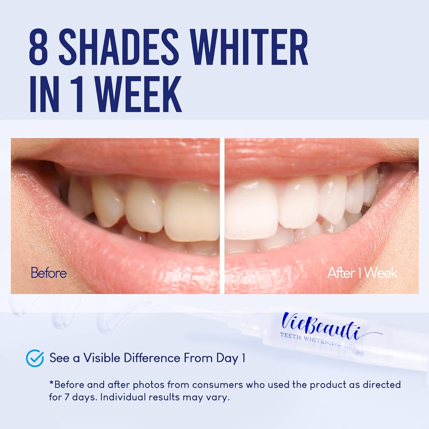 VieBeauti Teeth Whitening Kit with LED Light: Tooth Whitener with 35% Carbamide Peroxide, Remineralizing Gel, Mouth Trays and Tray Case - 10-Minute Timer Enhances Minty Fresh White Smile Mint - Image 2