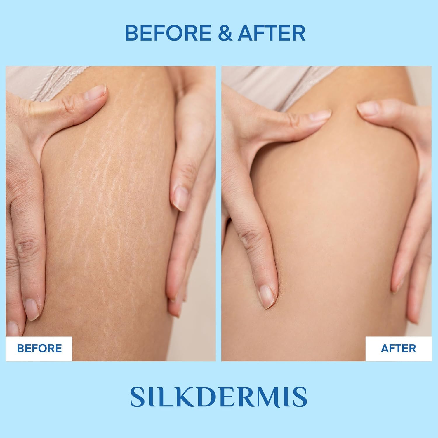 Skin Toning and Firming Gel: Skin Tightening Cream for Body - Effective Cellulite Cream for Tighs Buttocks & Stomach (6.7 Ounce (Pack of 1)) - Image 5