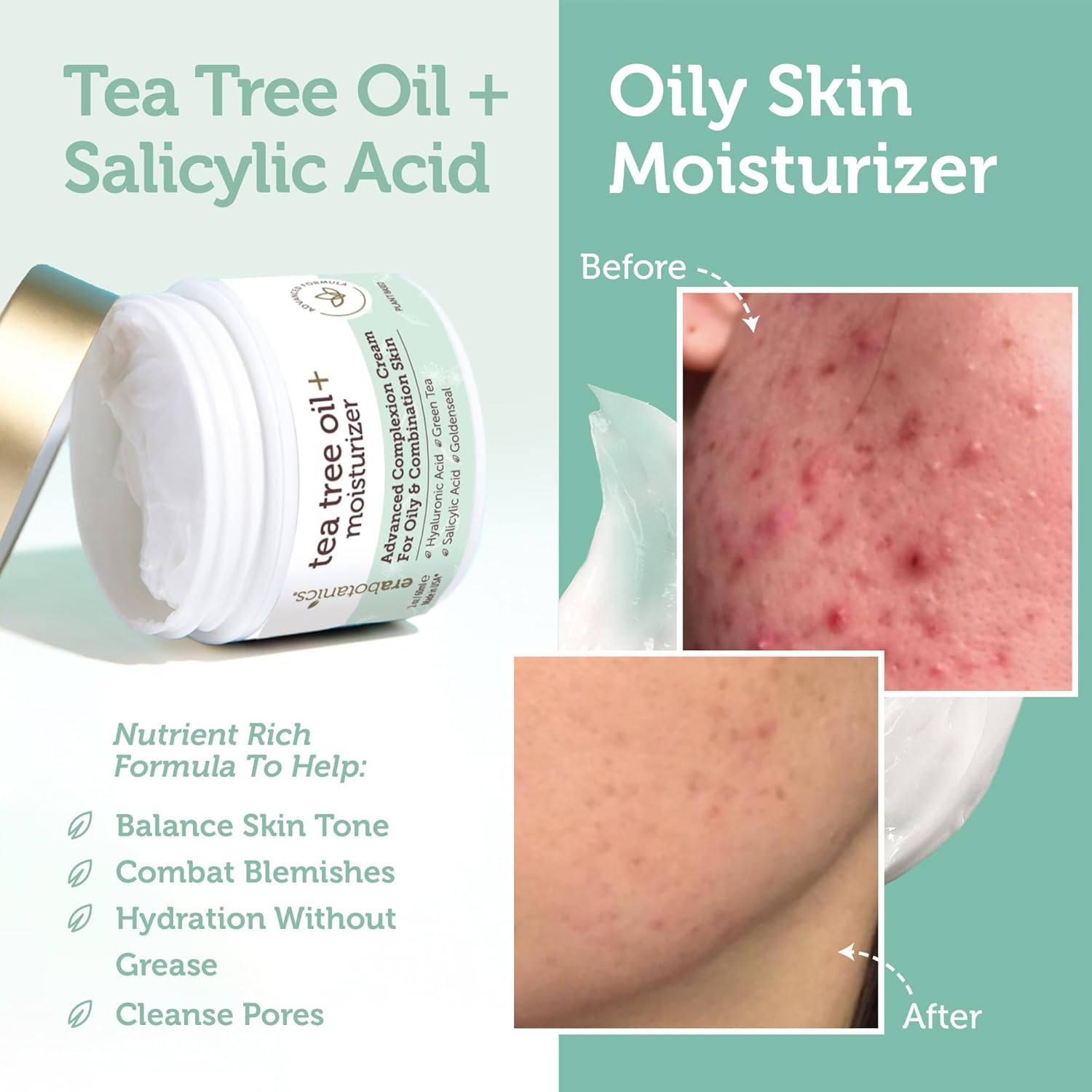 Era Organics Tea Tree Cream Face Moisturizer for Oily Skin - Advanced 7X Balancing Oily Skin Moisturizer - Non-Greasy Moisturizer - Tea Tree Oil for Skin - Image 2