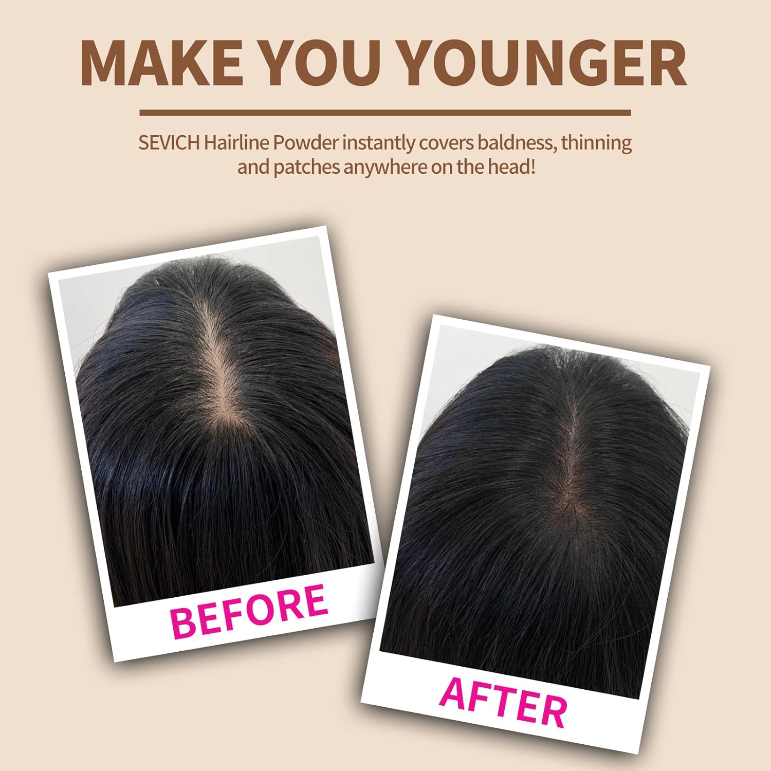 Sevich Hairline Powder,Instantly Conceals Hair Loss, Root Touch up Powder, Hair Shadow Toppers for Women & Men, Touch Up for Thinning Gray Hair, Windproof & Sweatproof, Black - Image 4
