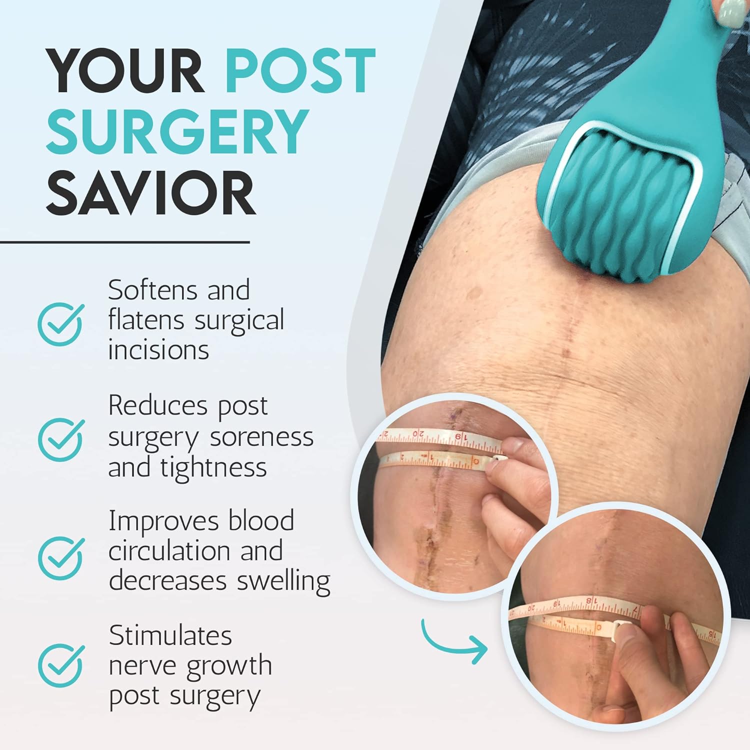Scar Roller, Scar Tissue Massager for Post-Surgery Recovery, Silicone Ice Massage for Post-Surgery Incision Swelling and Soreness, Joint Roller for Improved Range of Motion and Flexibility. Teal - Image 4