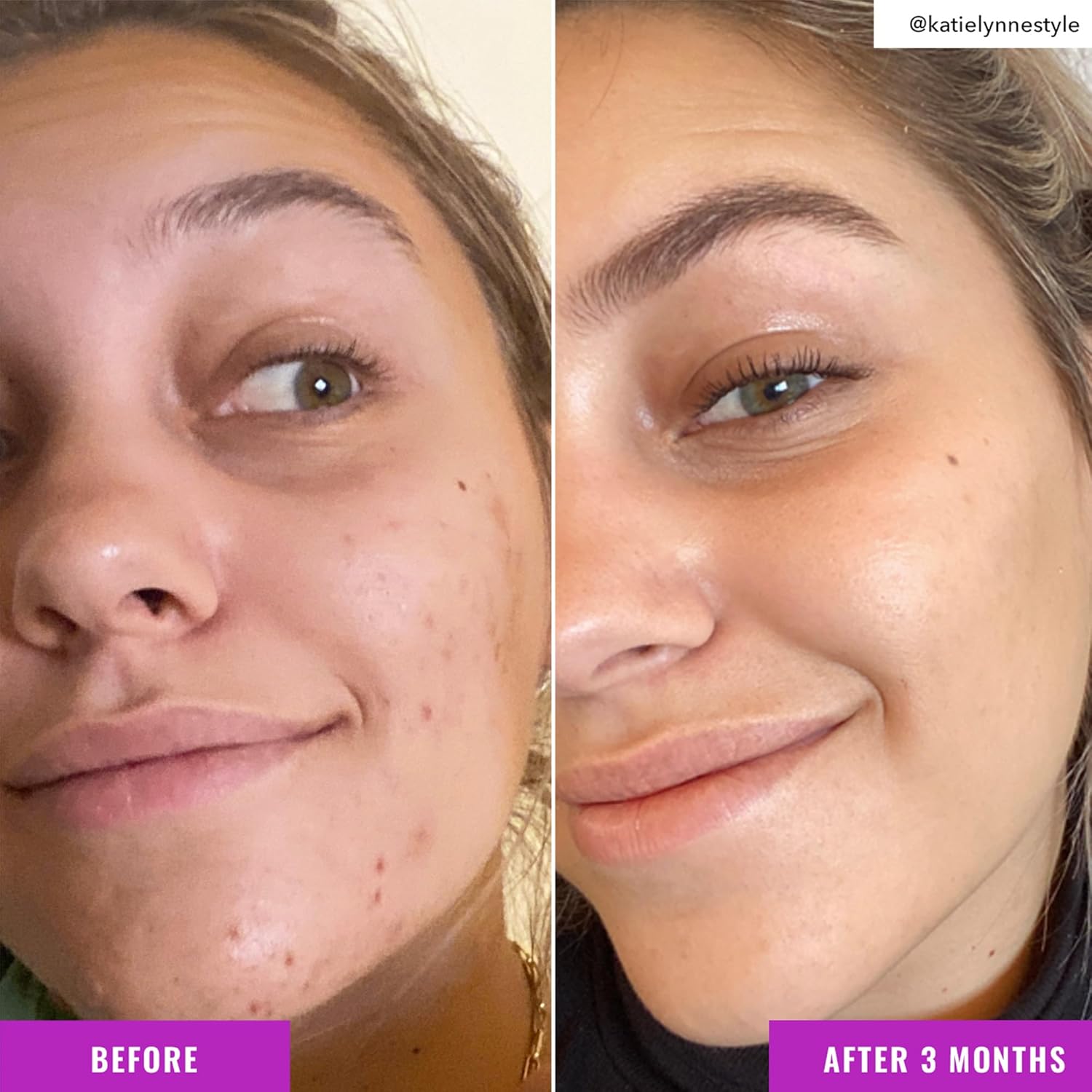 Good Molecules Niacinamide Brightening Toner - Toner for Face with Niacinamide and Arbutin for Skin Tone Balancing- Pore Minimizer, Facial Skin Care - Image 5