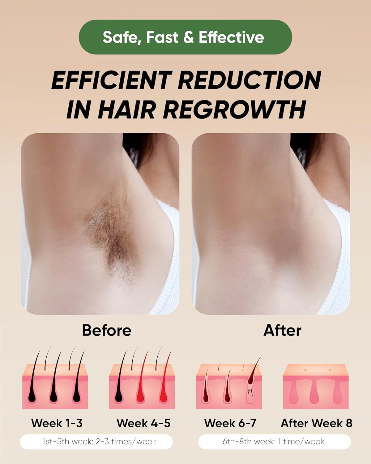 At-Home IPL Hair Removal for Women and Men Permanent Hair Removal 999,999 Flashes Painless Hair Remover on Armpits Back Legs Arms Face Bikini Line, Corded - Image 5