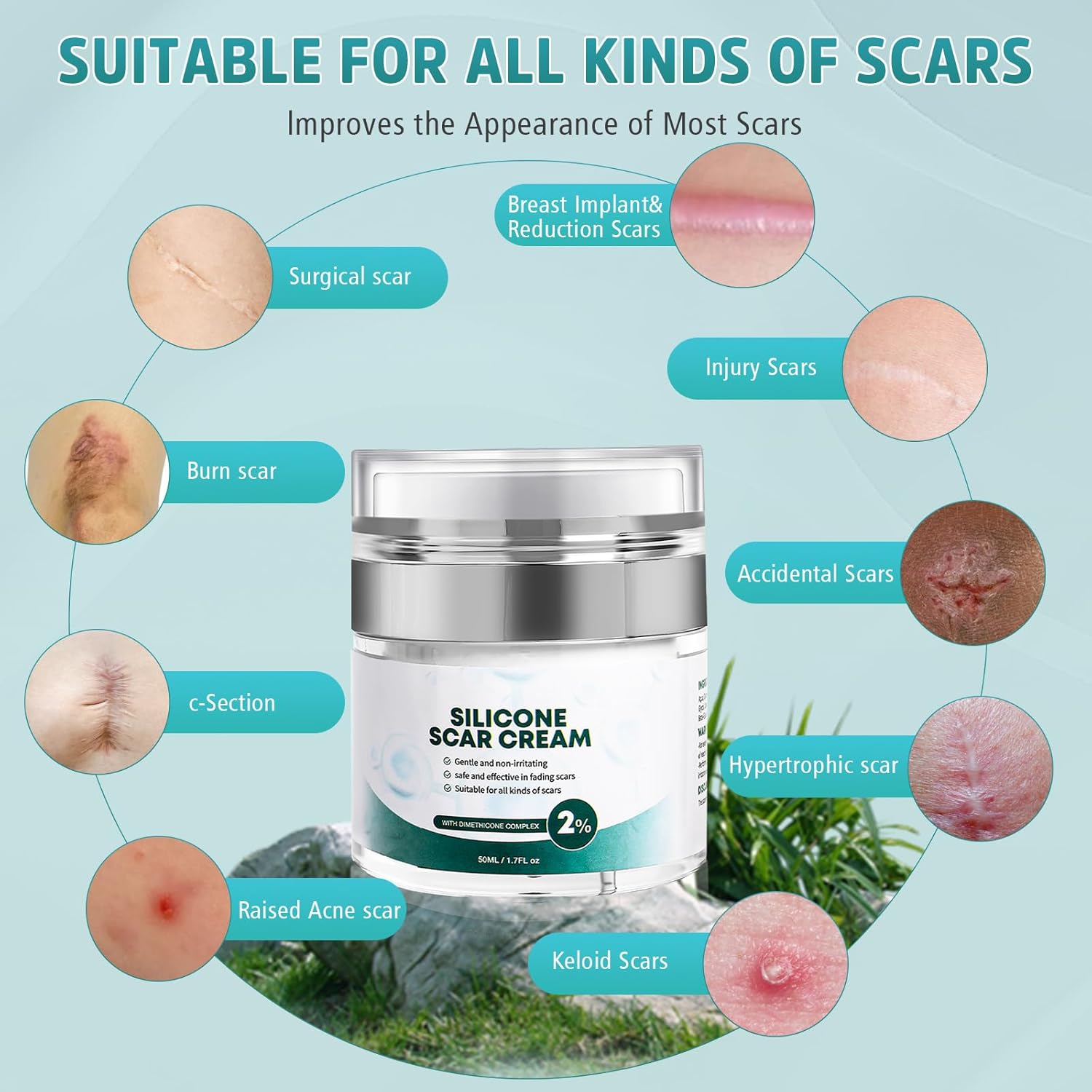 Advanced Scar Cream, Silicone Gel for Scars, Professional Scar Removal Cream for Surgical Scars, Stretch Marks, Old and New Scars 1.7 oz(50ml) - Image 6