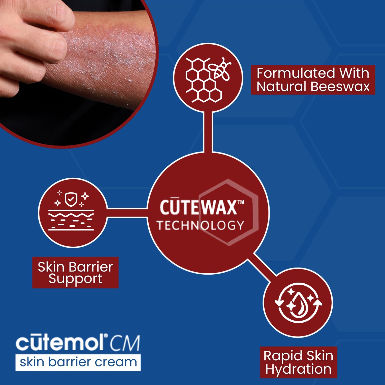 Cutemol CM Emollient Moisturizing Cream - For Severely Dry and Damaged Skin - Natural Beeswax Formulation containing Ceramides - Hydration for Cracked Hands and Feet, Eczema, Psoriasis (8 oz) - Image 4