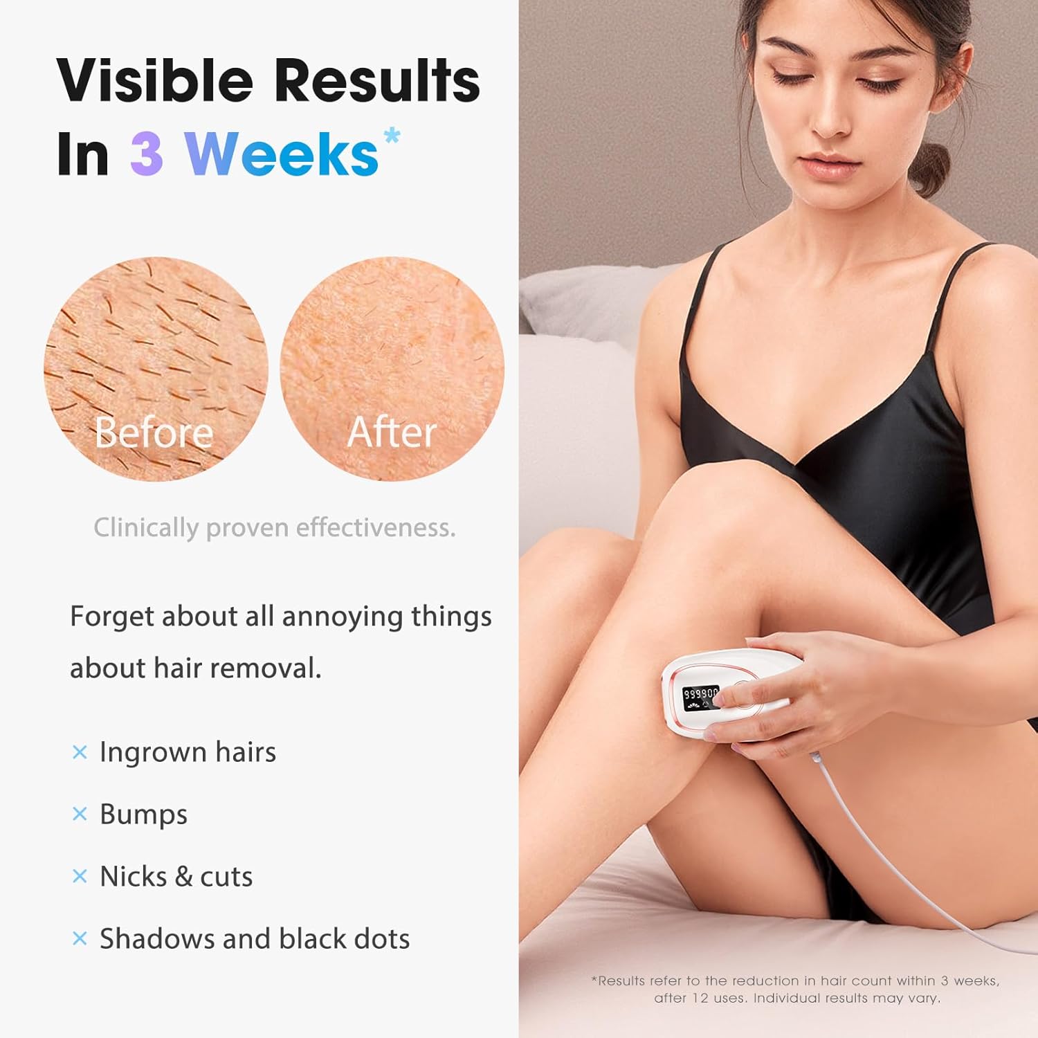 IPL Laser Hair Removal Device for Women & Men - Home 45°F Ice-Cooling Contact for Painless & Long-Lasting Results, 86% Hair Reduction in 3 Weeks for Full Body & Bikini Line, White - Image 2