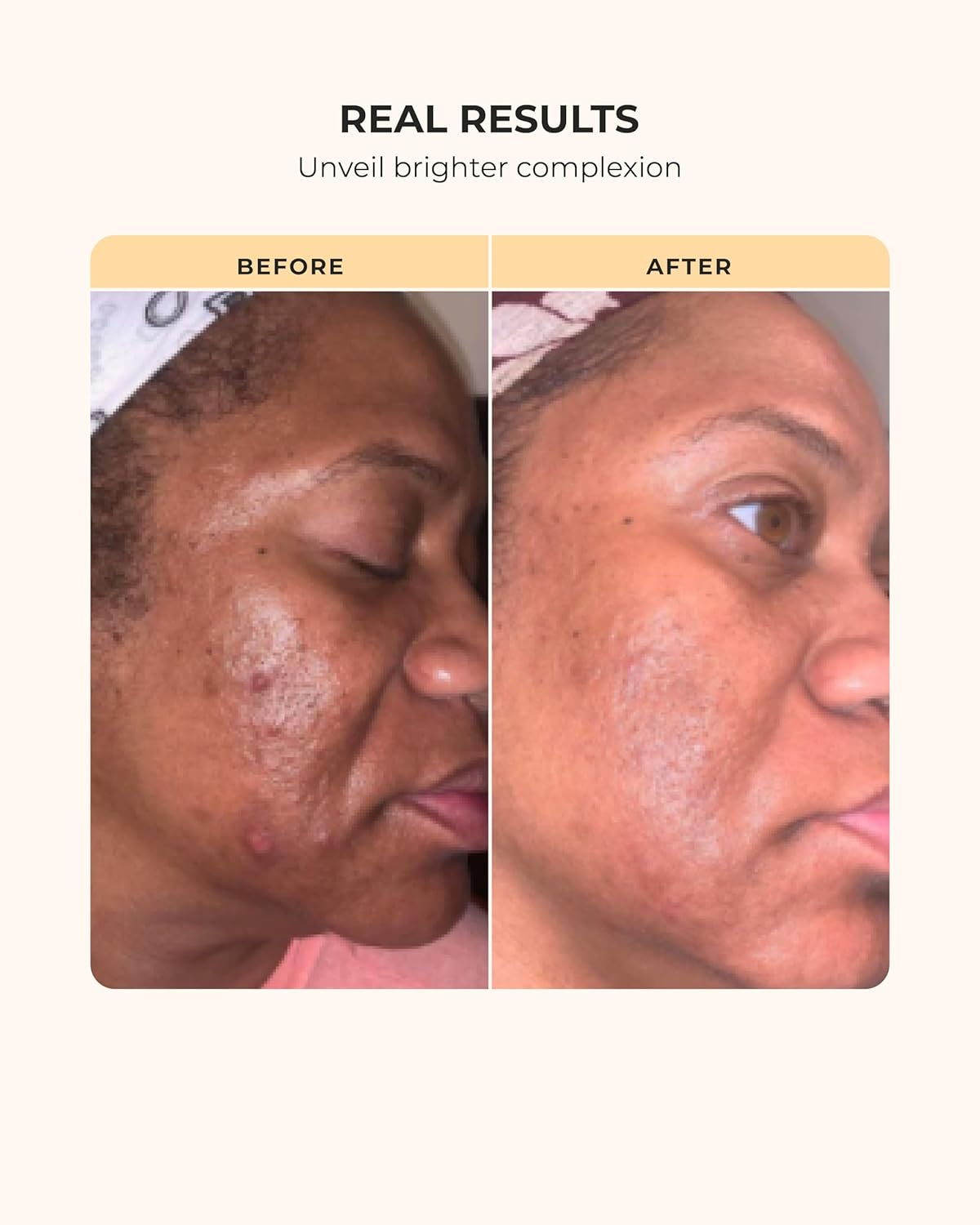 Buttah Skin Transforming Kit for Melanin Rich Skin | CocoShea Revitalizing Cream 2 oz | Vitamin C Serum 1 oz | Buttah Cleanser 3.4 oz | Black Owned Skincare - Image 6