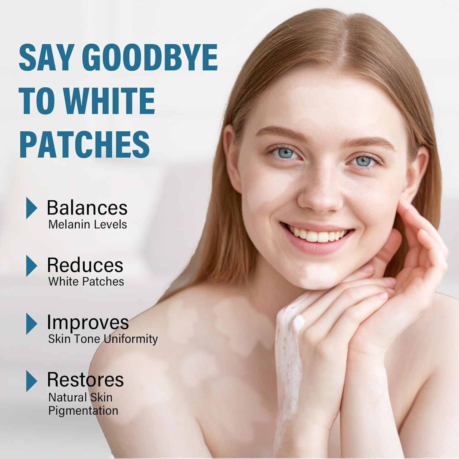 MOSKILA Vitiligo Treatment, Effective Vitiligo Cream for Skin Vitiligo, Reduce White Spots on Face or Body, Improves for Skin Pigmentation, Suitable for All Men and Women - Image 3