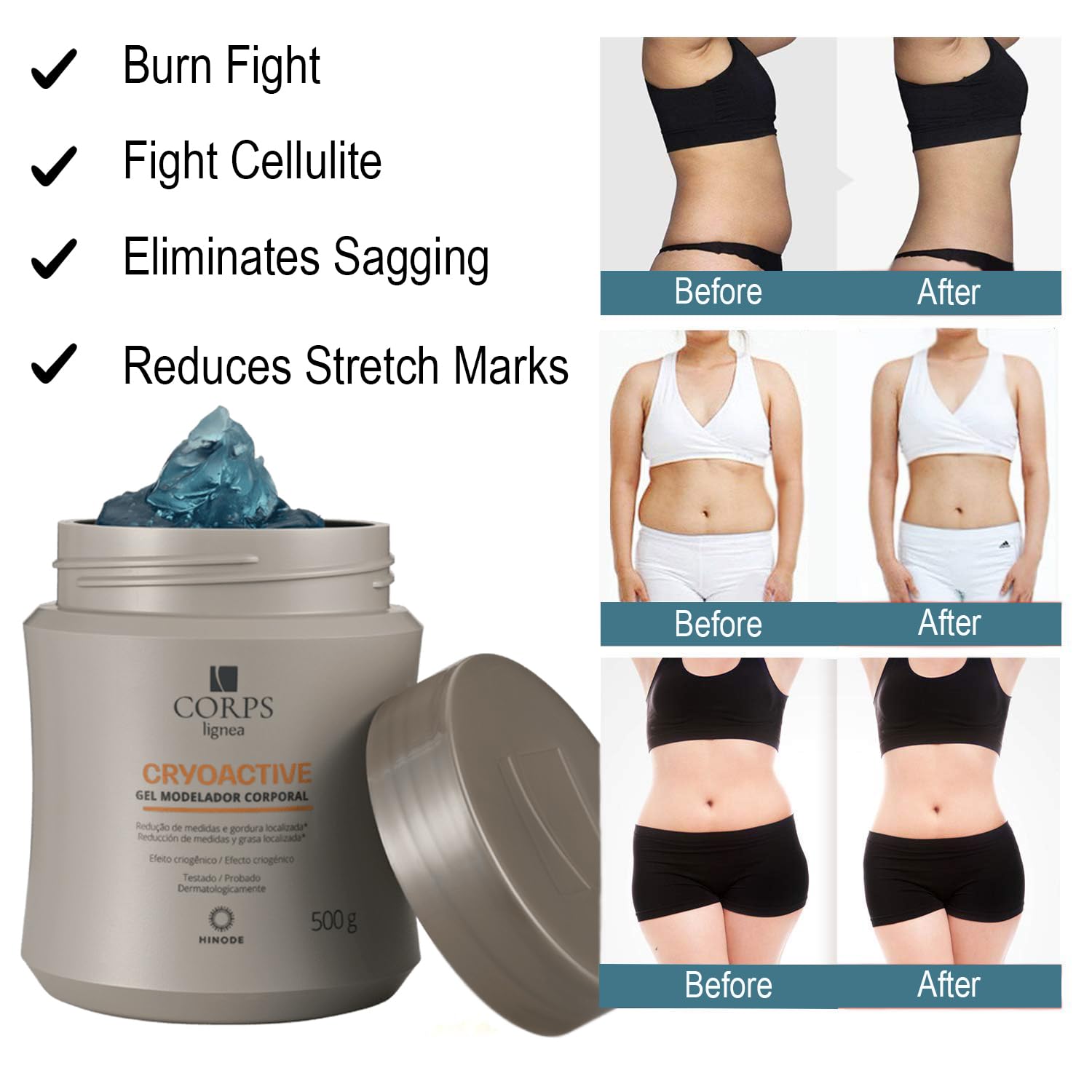 CRYOACTIVE SLIM GEL, Body Contour Gel for Firmer Skin, Anti-cellulite for Men & Women, Tightening Gel for Tummy, HIPS and Buttocks - Image 2