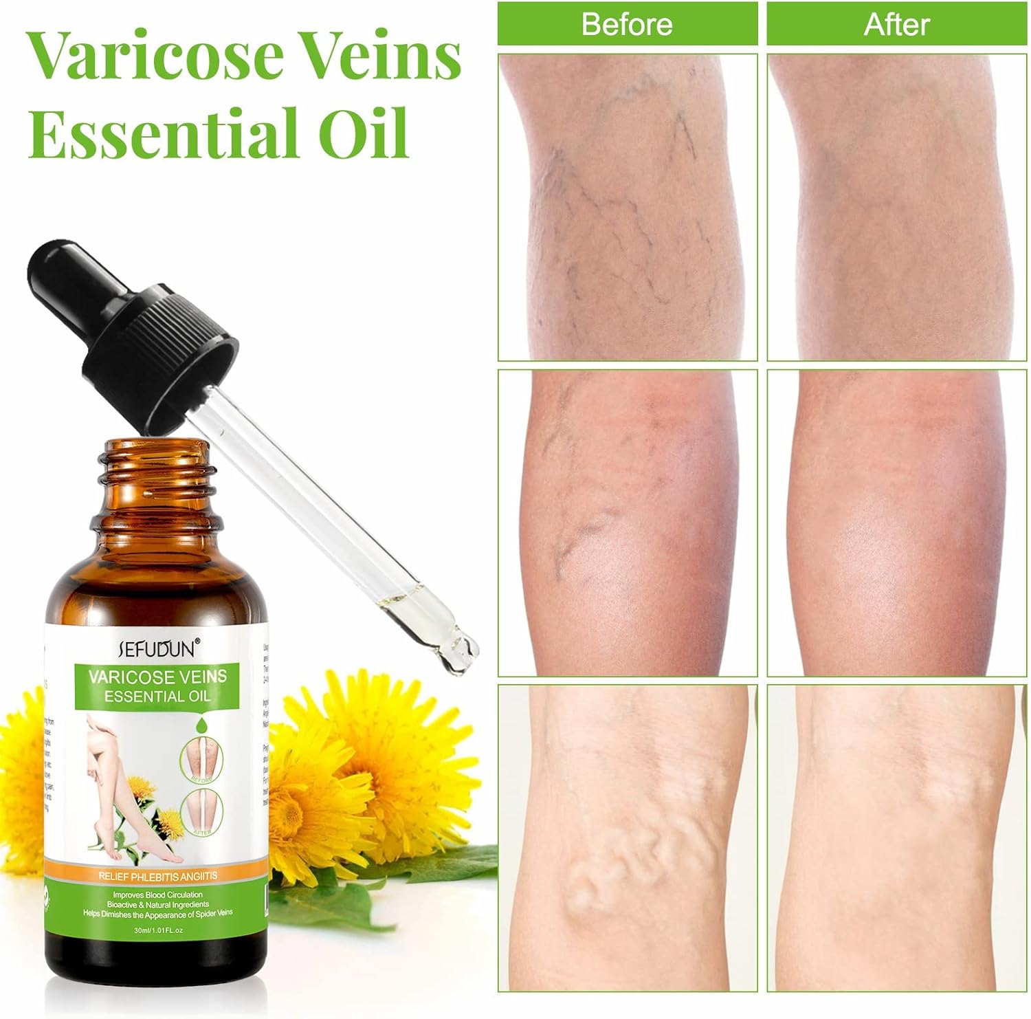 Varicose Veins Essential Oil, Spider Vein Removal Oil for Legs, Natural Varicose Veins Oils 30ML - Image 6