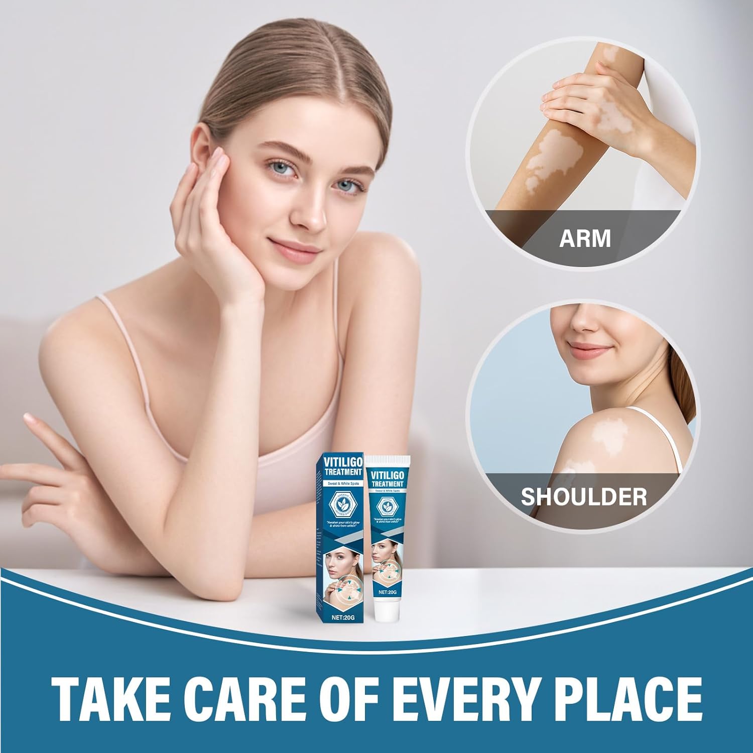 MOSKILA Vitiligo Treatment, Effective Vitiligo Cream for Skin Vitiligo, Reduce White Spots on Face or Body, Improves for Skin Pigmentation, Suitable for All Men and Women - Image 4