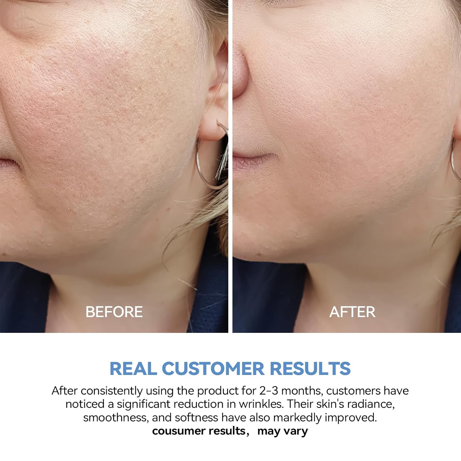 Ultra Hydrating Serum 3% 4D Hyaluronic Acid Smoother Skin|Pre-makeup SkinCare|Anti-Aging serum for face Single-Use Vials Skincare for Dry&Sensitive skin(1.2 ml)*30 - Image 9