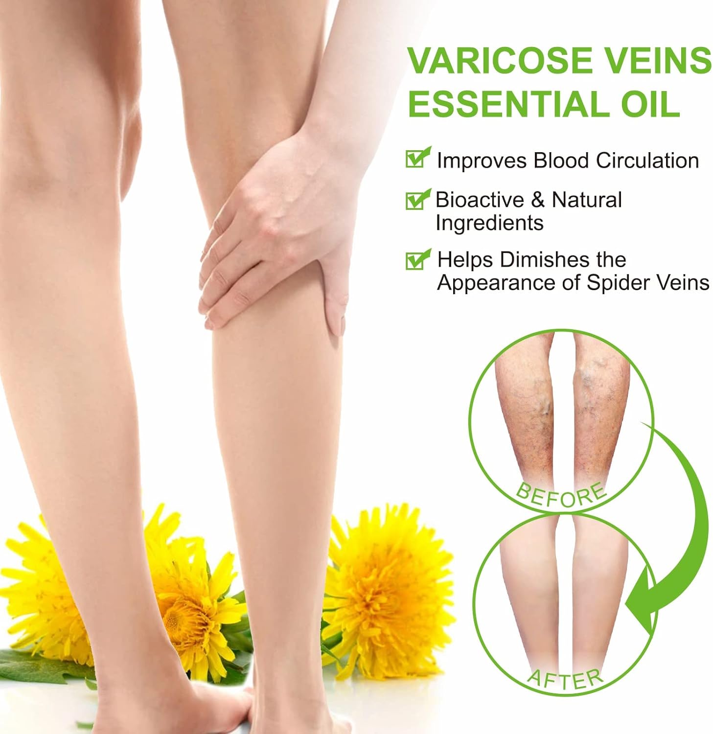 Varicose Veins Essential Oil, Spider Vein Removal Oil for Legs, Natural Varicose Veins Oils 30ML - Image 2
