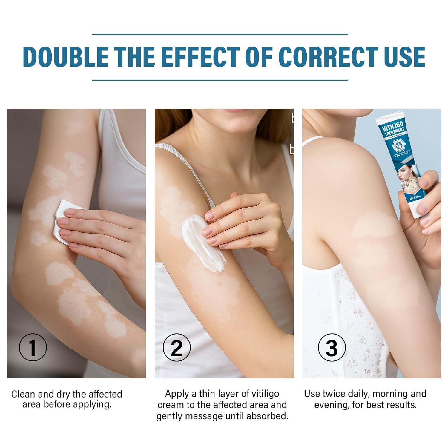 MOSKILA Vitiligo Treatment, Effective Vitiligo Cream for Skin Vitiligo, Reduce White Spots on Face or Body, Improves for Skin Pigmentation, Suitable for All Men and Women - Image 6