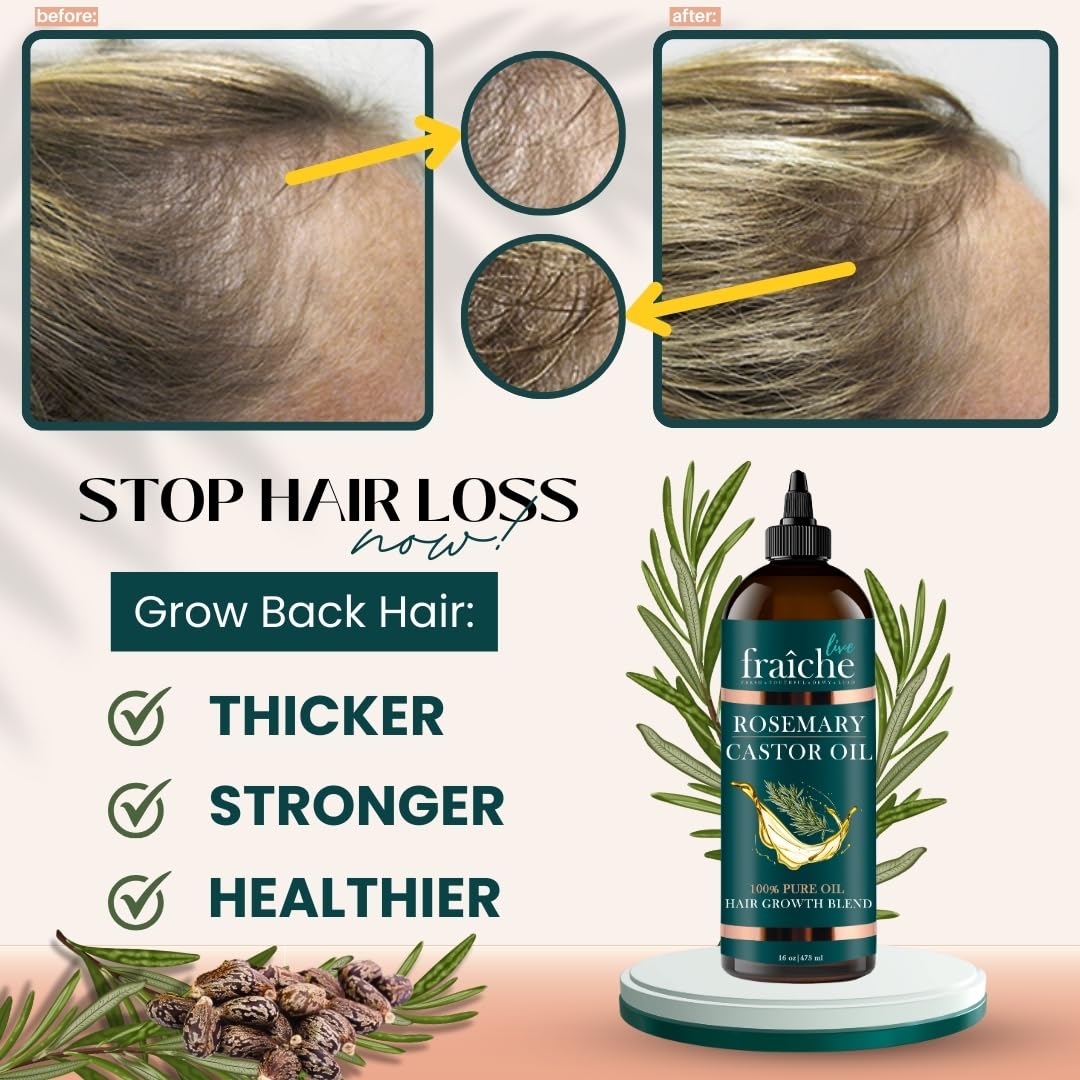 Live Fraiche Rosemary Castor Oil for Hair Growth 16oz - Rosemary Oil for Hair Growth and Thickening Pure Blend to Reduce Loss and Promote a Healthy Scalp - Image 2
