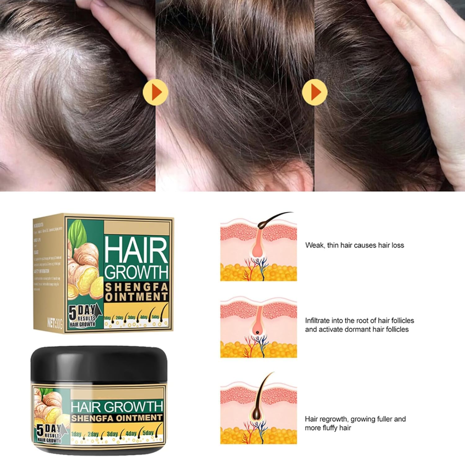 Ginger Hair Growth Ointment Hair Regrowth Treatment Cream Moisturizing Scalp Massage Hair Follicle Hair Care Serum Essence Conditioner (3.34 oz) - Image 6