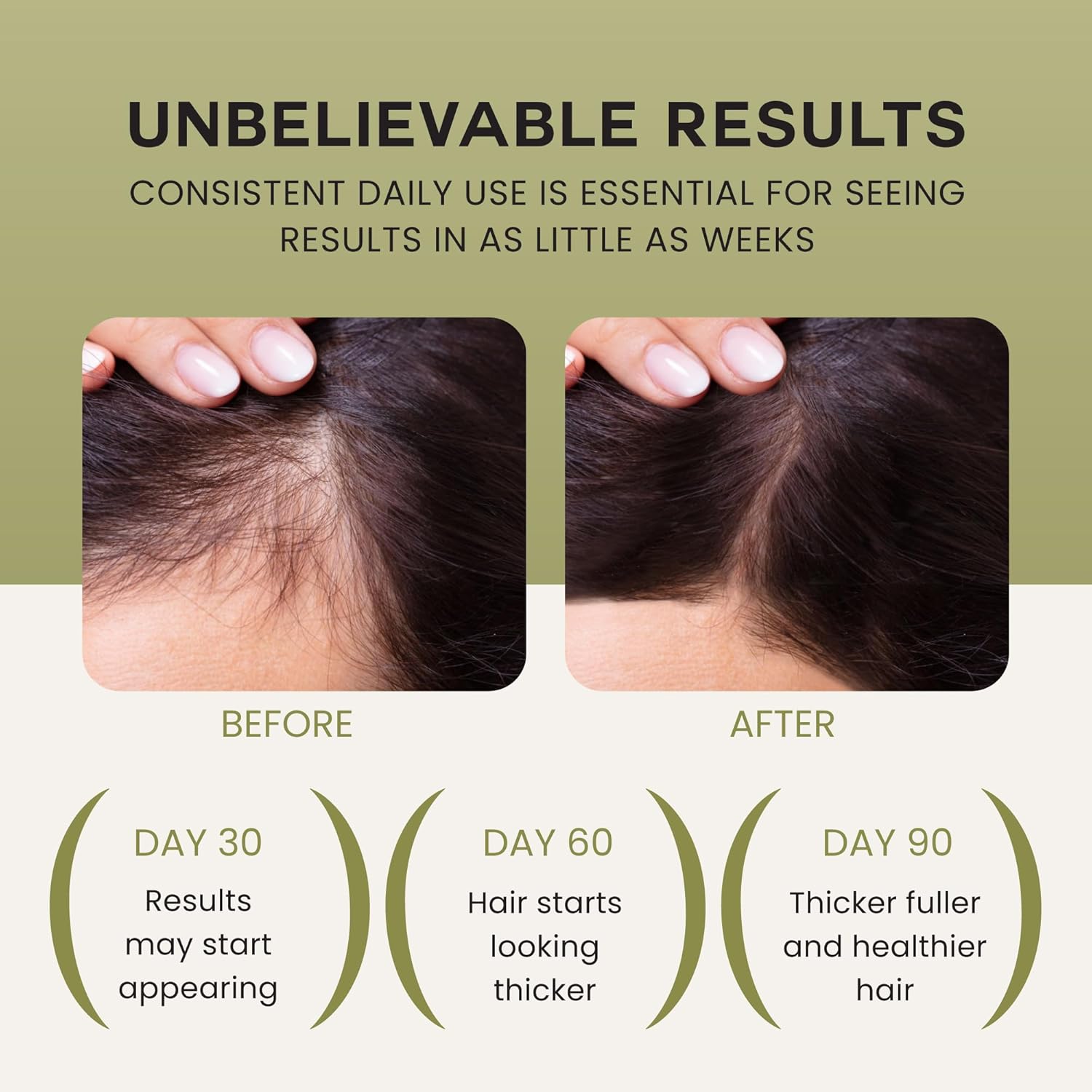 Batana Oil For Hair Growth - 100% Pure, Raw & Natural Blend With Organic Castor, Pumpkin Seed, Coconut and Rosemary Oil - Thicker, Stronger Hair For Men & Women Scalp (1 Pack) - Image 3