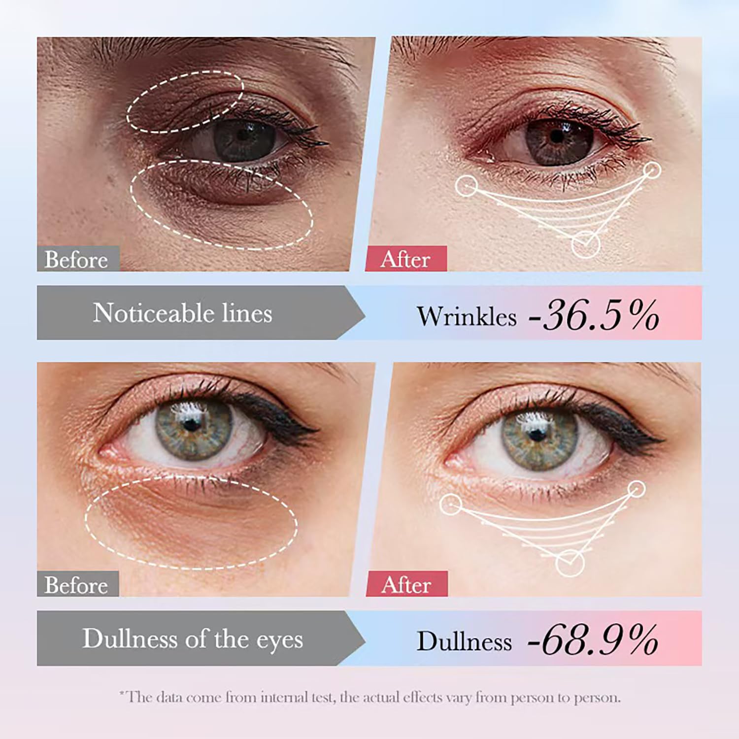 Eye Cream with 10% Hyaluronic Acid, 5% Nicotinamide, 30% Retinol, 10% Vitamin C for Puffy Eye Bags Fine Lines Dark Circles Wrinkles, Under Eye Cream with 360° Eye Roller Massage Ball, 0.7 fl. oz - Image 6