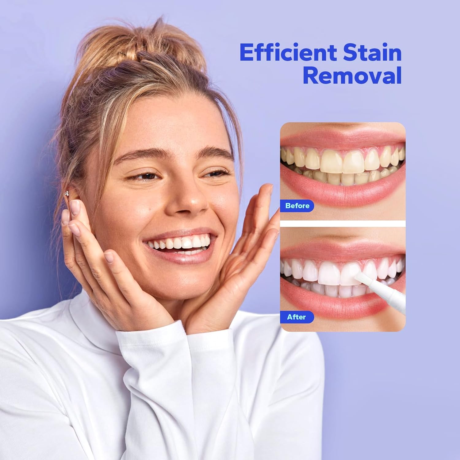Teeth Whitening Pen (4 Count), No Sensitivity Teeth Whitening Gel, Effective Teeth Whitener, Travel-Friendly Tooth Whitening Pen, Carbamide Peroxide Tooth Bleaching Gel for Adults - Image 2