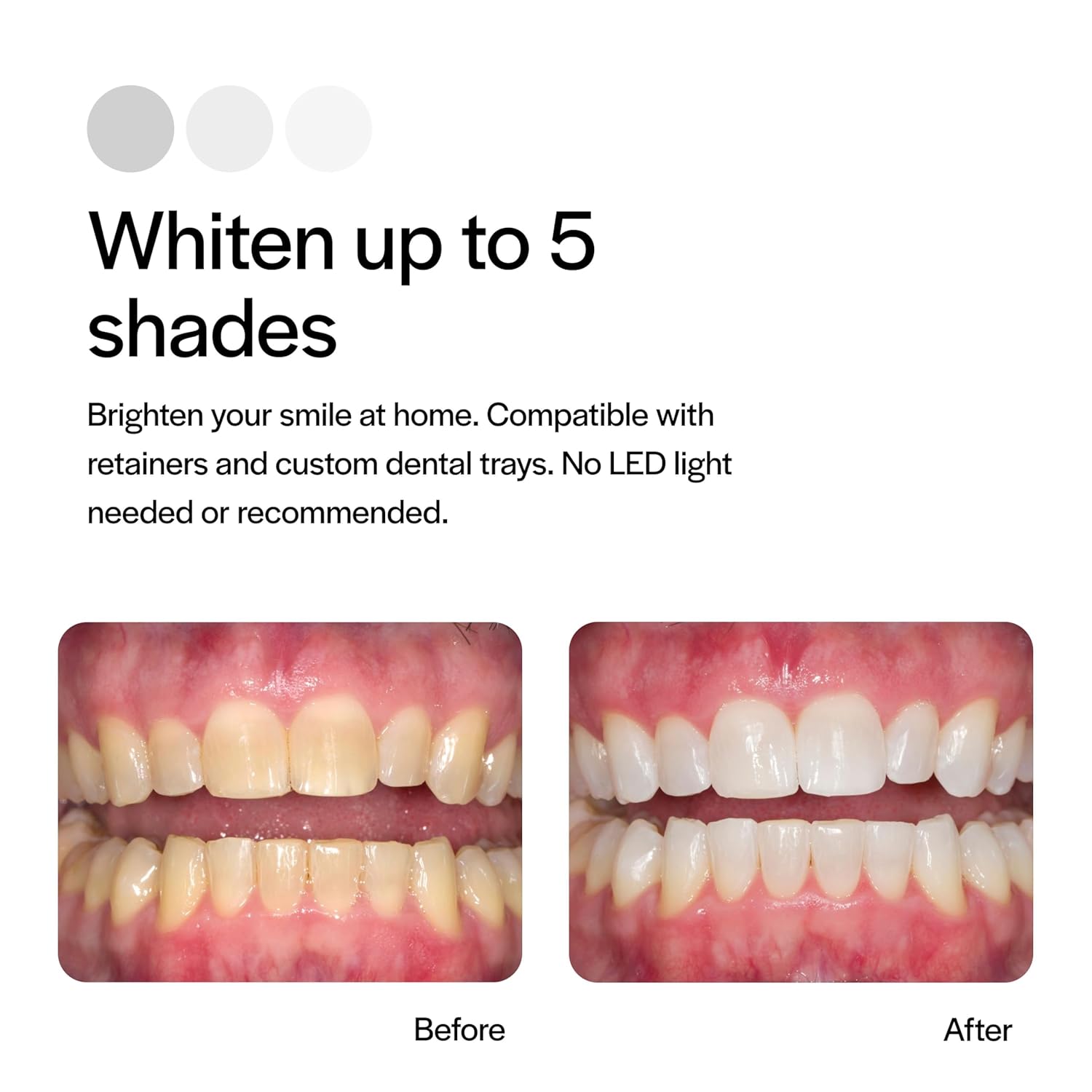 Opalescence 20% Teeth Whitening Refill Kit (2 Packs / 4 Syringes) Carbamide Peroxide. Made by Ultradent, in Mint Flavor. Tooth Whitening Refill Syringes - B-5196-4 - Image 4