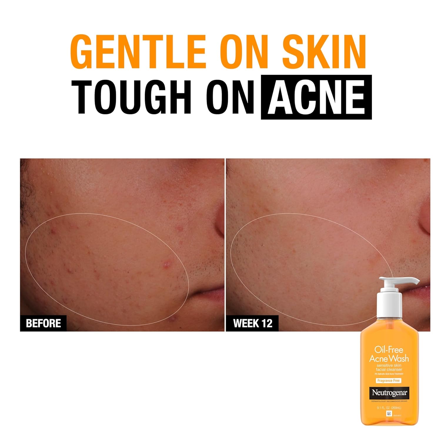 Neutrogena Oil-Free Acne Face Wash, Sensitive Skin Facial Cleanser with 2% Salicylic Acid Acne Treatment, Daily Fragrance Free Face Wash for Acne Prone Skin, 9.1 fl oz - Image 4