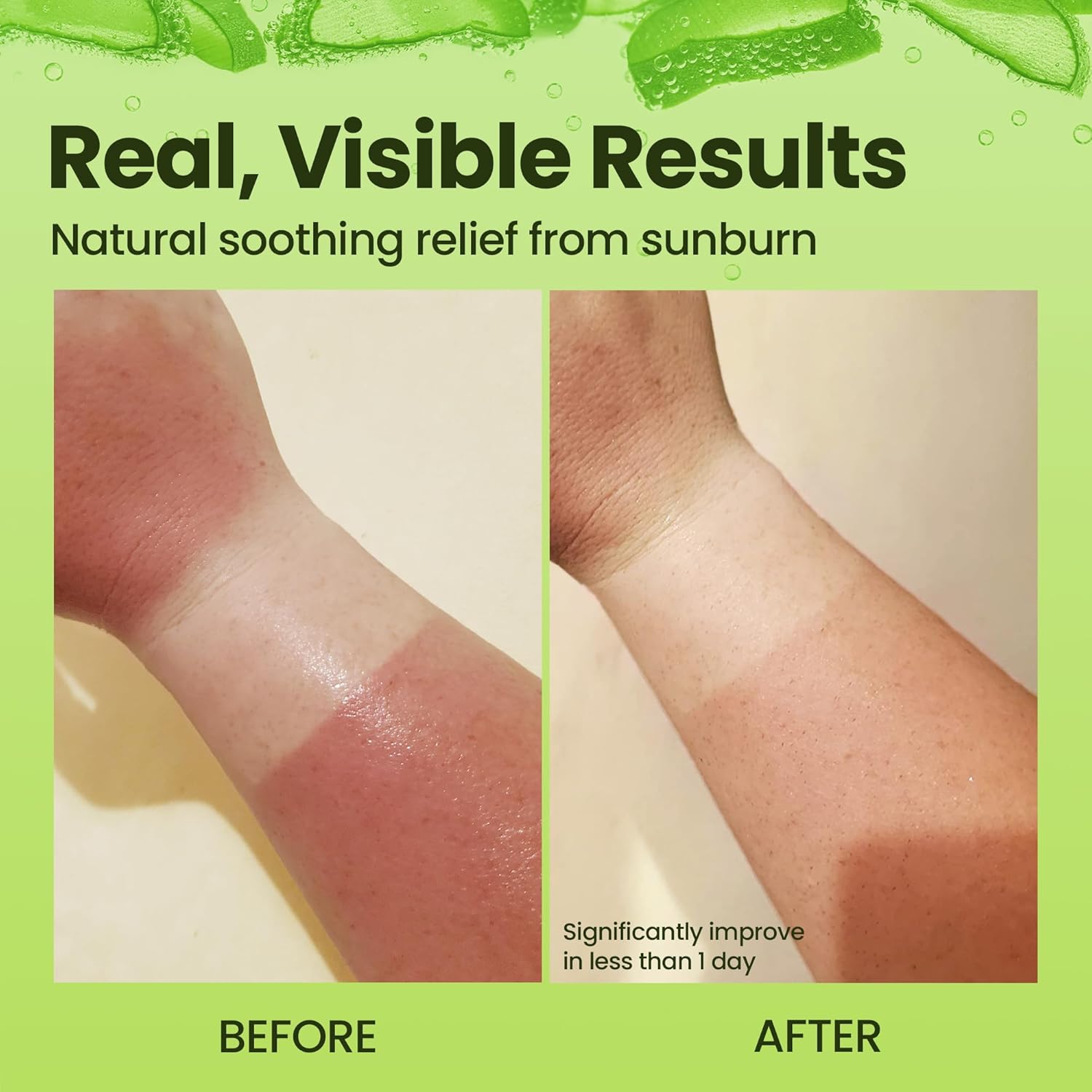 Organic Aloe Vera Gel - 100% Pure for Skin, Sunburn Relief & Face Moisturizer - Extracted from Aloe Vera Plant with Manuka Honey, Orchid & Apple Stem Cells - Everyday Use - 64 fl oz - Image 5