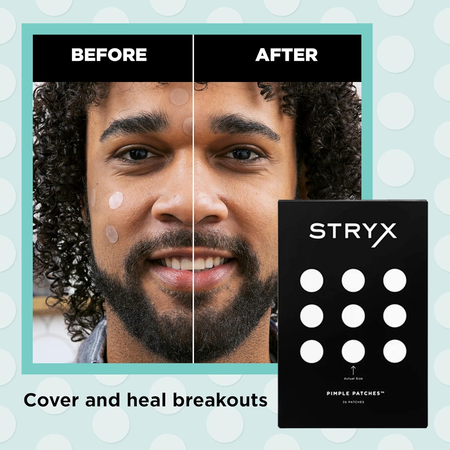 Stryx Hydrocolloid Acne Pimple Patches for Men - Great for Breakouts, Zits, Blemishes, Whiteheads, & Reducing Redness - Designed for Men’s Larger Pores - Ultra-thin, Invisible Application - Image 2