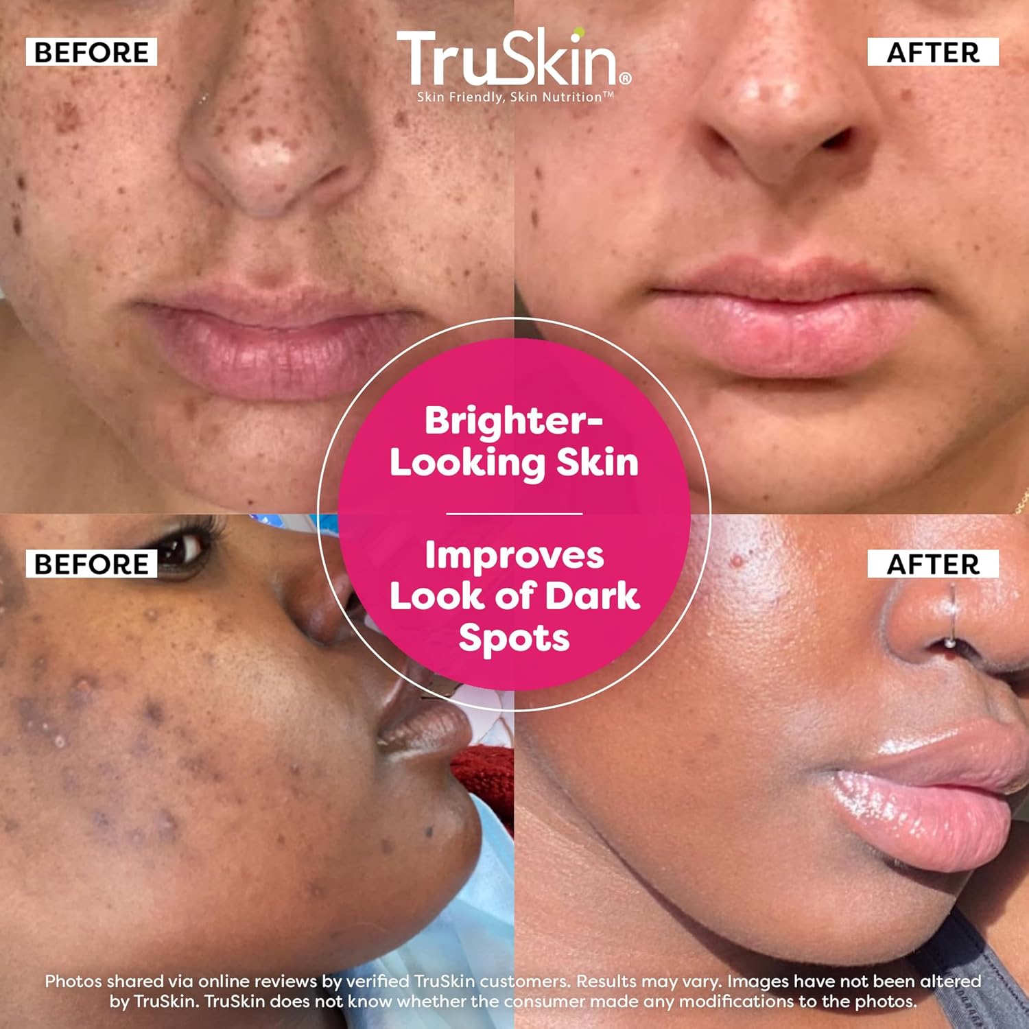 TruSkin Vitamin C Super Serum - Niacinamide, Retinol, Hyaluronic & Salicylic Acid - All-in-One Anti Aging Serum for Face – Improve Appearance of Dark Spots, Firmness for Brighter Looking Skin, 1 Fl Oz - Image 2