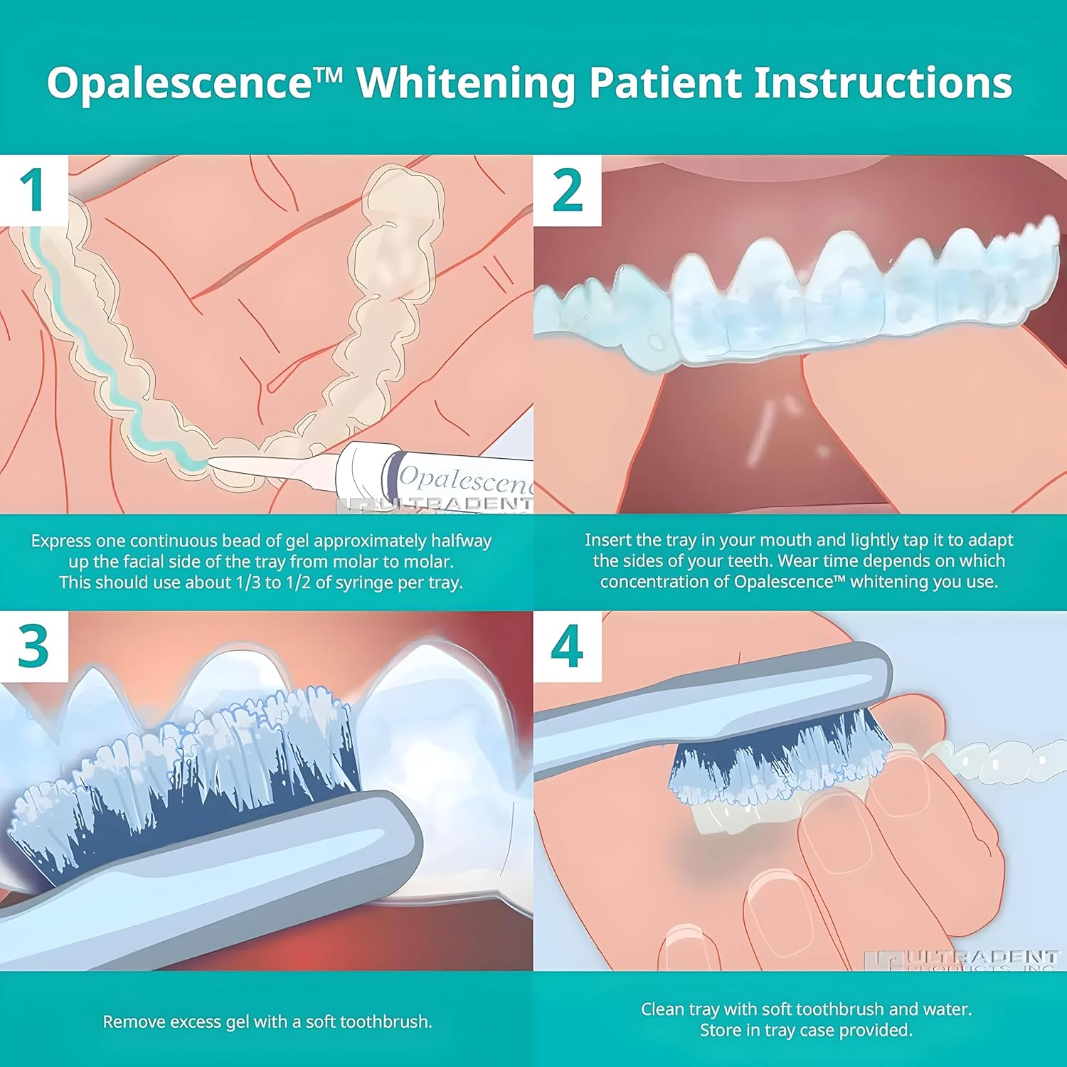 Opalescence 20% Teeth Whitening Refill Kit (2 Packs / 4 Syringes) Carbamide Peroxide. Made by Ultradent, in Mint Flavor. Tooth Whitening Refill Syringes - B-5196-4 - Image 5