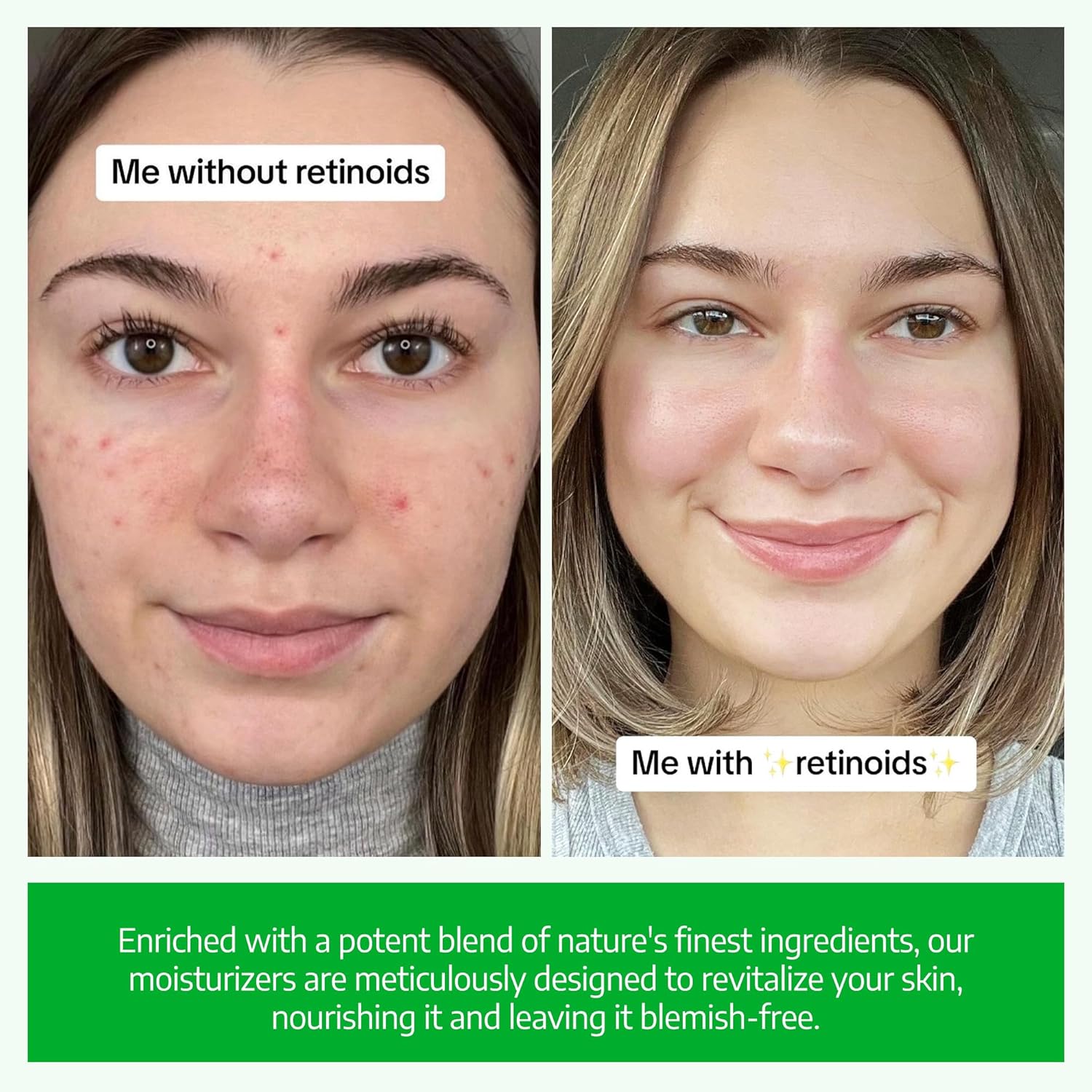USDA Organic Retinol Face Cream 2.5% - Beginner-Friendly Anti Aging Moisturizer for Sensitive Skin with Liposomal, Hyaluronic Acid & Collagen Booster - Fragrance Free, Made in USA, 2 oz - Image 3