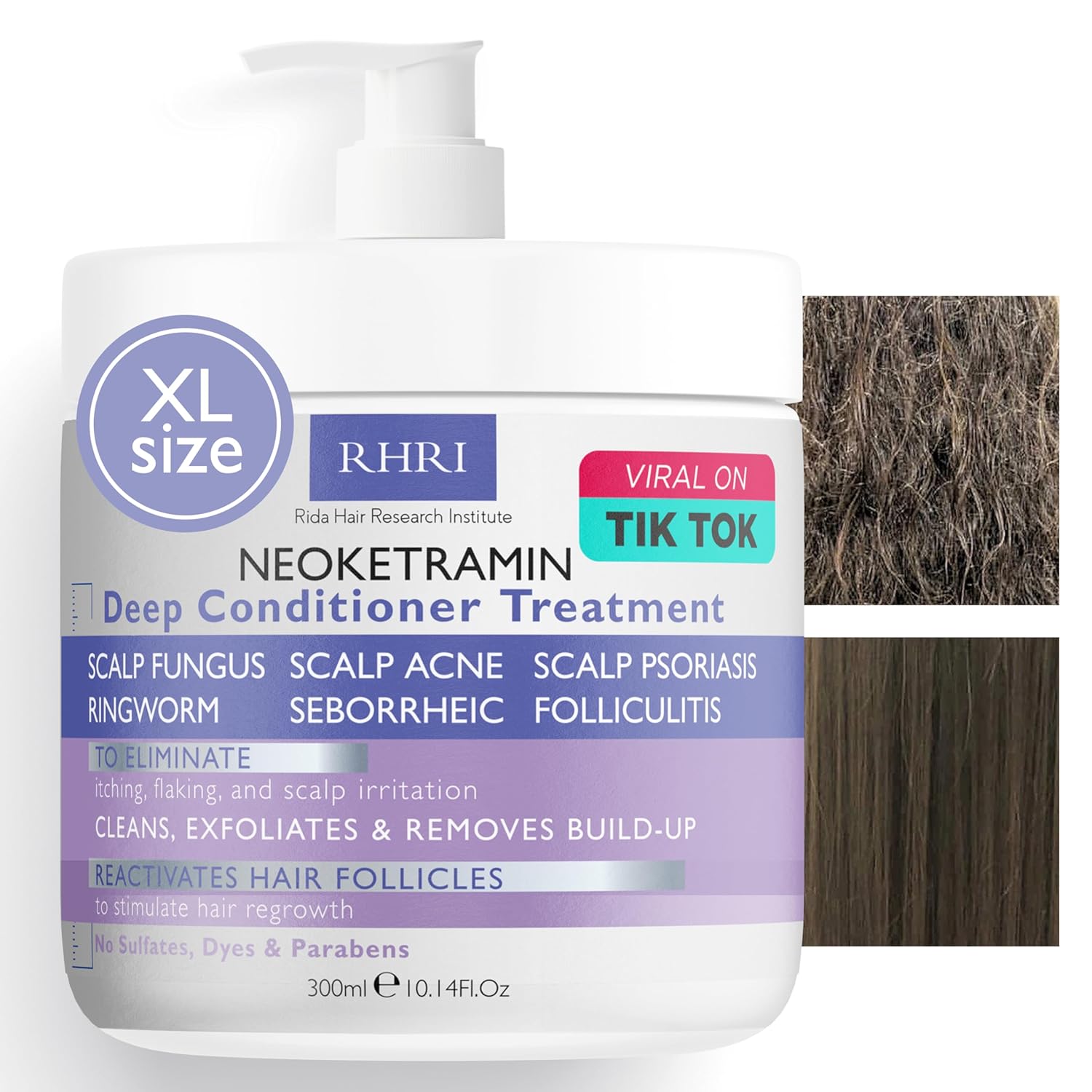 Anti Fungal Deep Conditioner for Men and Women | Scalp Treatment for Psoriasis, Dandruff, Seborrheic Dermatitis | Provides Relief from Folliculitis, Eczema, Itchy , Flaky and Dry Scalp