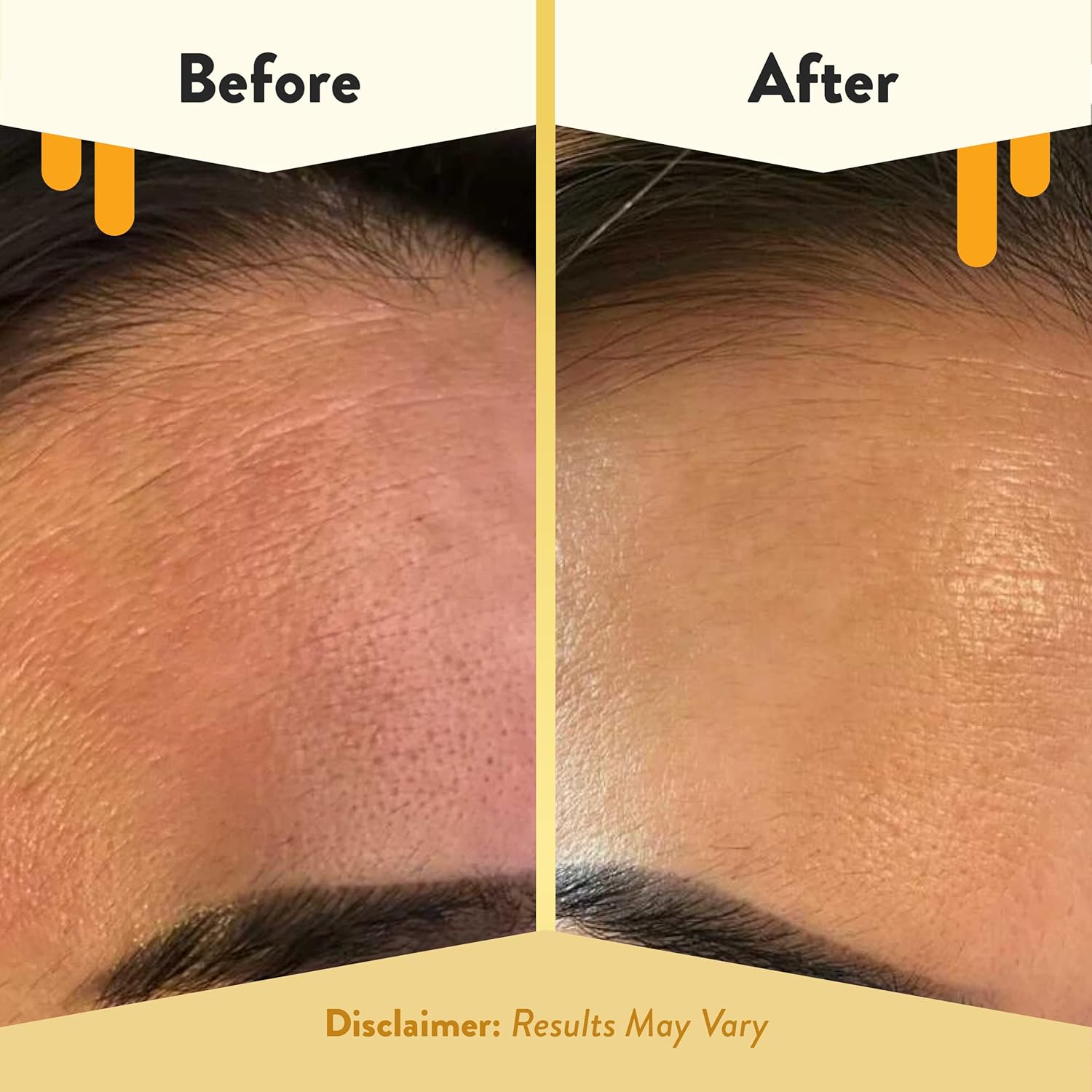 ECZEMA HONEY Concentrated Nighttime Renewal Face Cream - Anti Aging Skin Care Products - Unscented Face Moisturizer for Eczema, Dry & Sensitive Skin (1.7 Oz) - Image 4