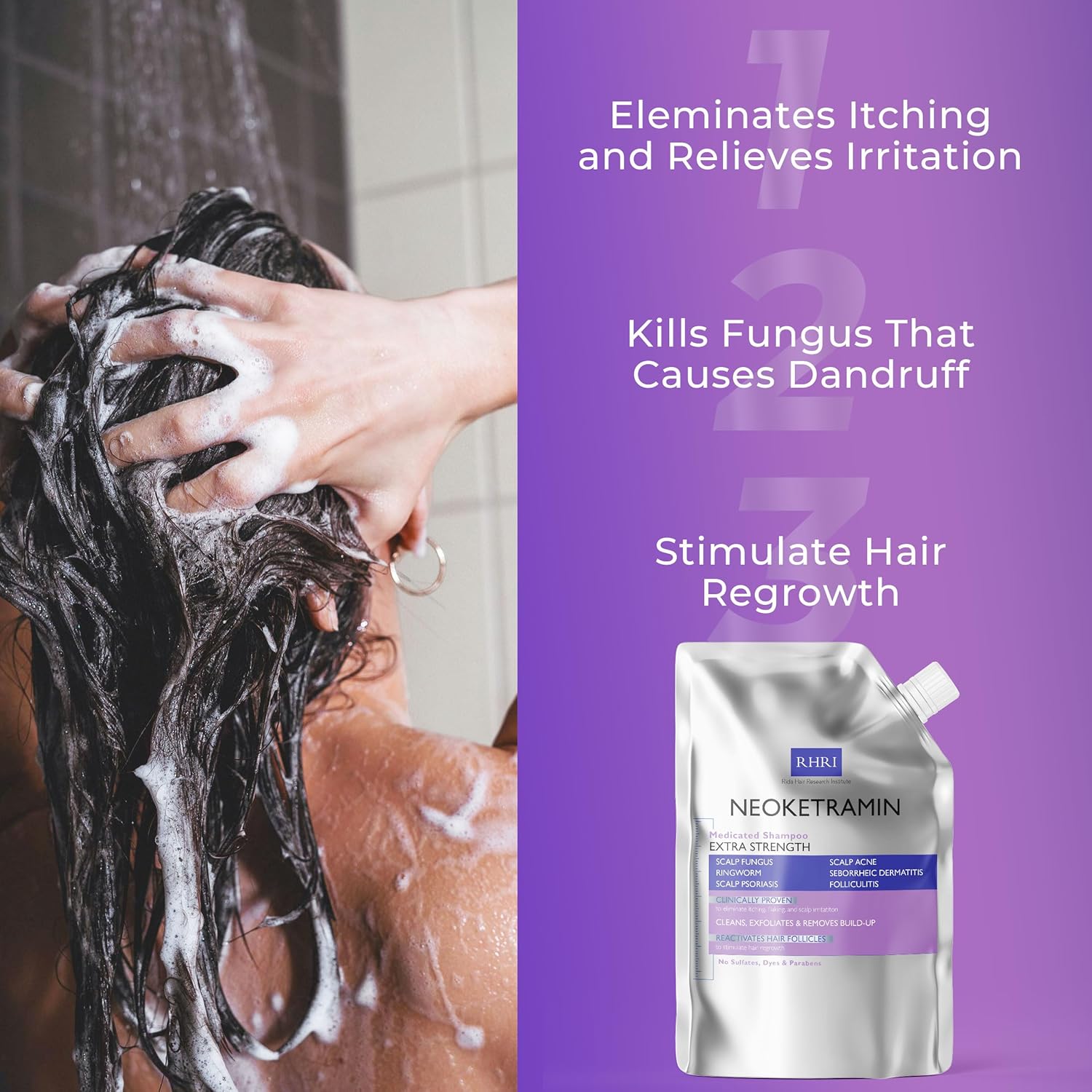 Anti Fungal Shampoo for Men & Women | Anti Dandruff, Medicated, Folliculitis Shampoo for Dry Scalp, Psoriasis, Ringworm | for Itchy, Flaky & Irritated Scalp | No Paraben & Sulphate - Image 7