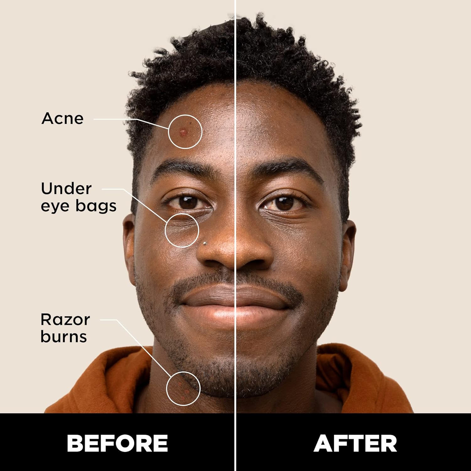 Stryx Concealer Stick Tool for Men, Dark Eclipse - Natural Pigments Hides Imperfections, Acne, Razor Burns, Scars, & Rosacea - Highly Adaptable Shades for Easy, Undetectable Coverage - All Skin Tones - Image 2