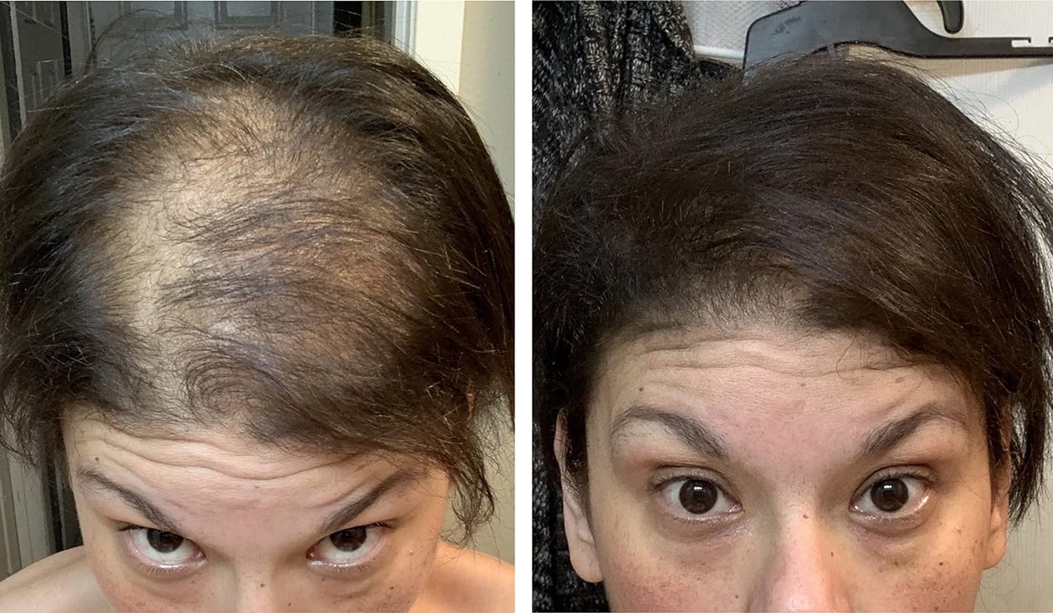 Hair Loss Concealer. Cover Bald Spot and Thinning Hair Instantly. Make Thin Hair Look 10X Fuller. All-Natural Hair Building Fiber. Trial Size (10-Day Supply). Dark Brown - Image 5
