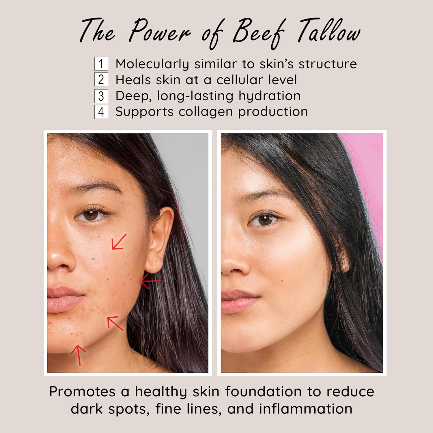 Whipped Milky Beef Tallow For Skin & Face | Made in USA | 100% Grass-Fed with All-Natural Organic Oils, Dewy Finish Beef Tallow Balm Moisturizer - For Sensitive Acne-Prone Skin, Tea Tree 2oz - Image 4